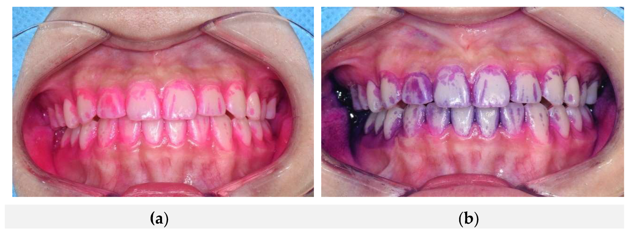 Preprints 157696 g002