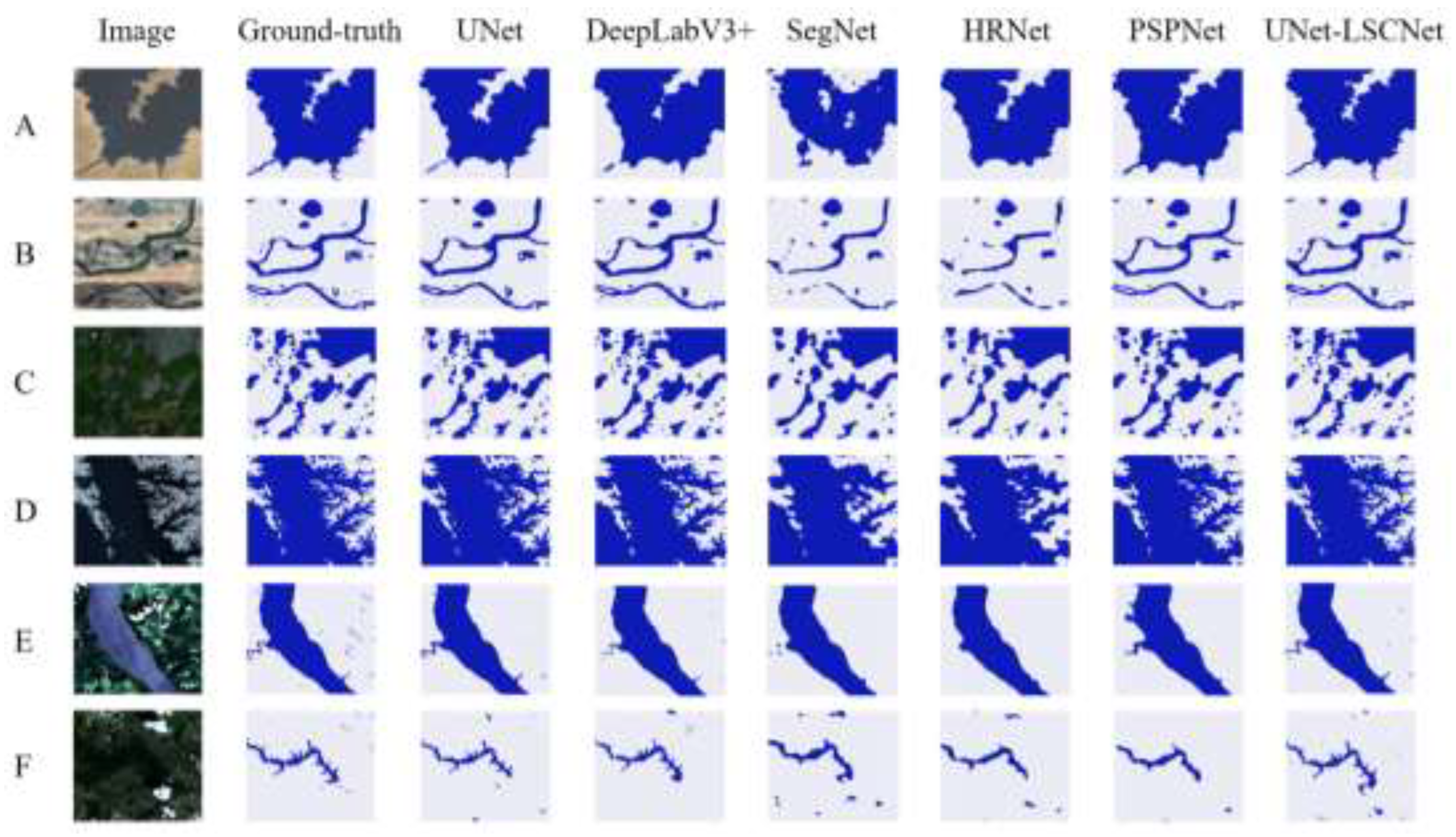 UNet-LSCNet: Integrating Dynamic Snake Convolution and Vision ...