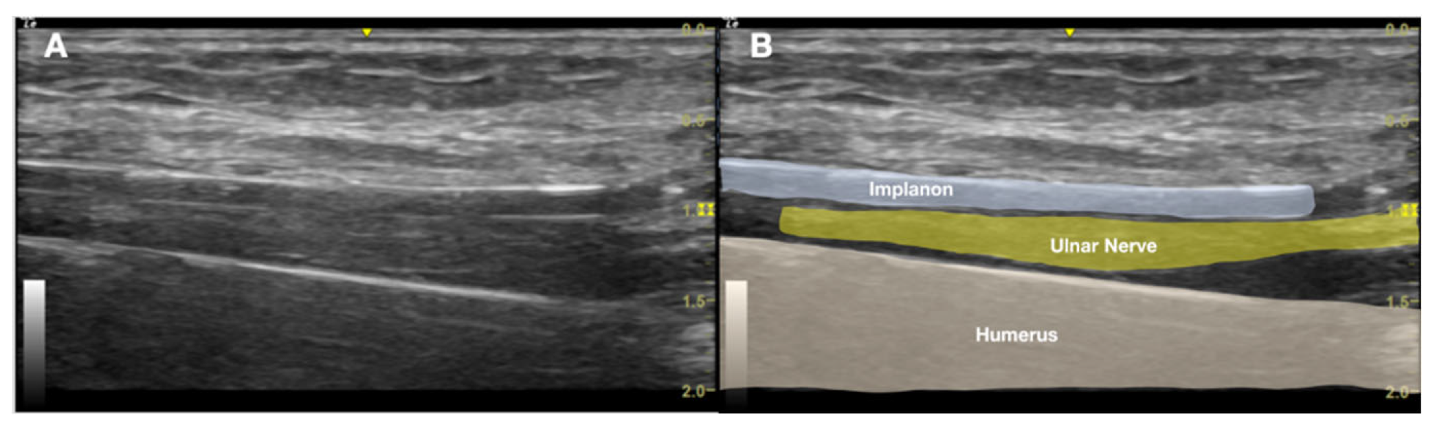 Preprints 171941 g004