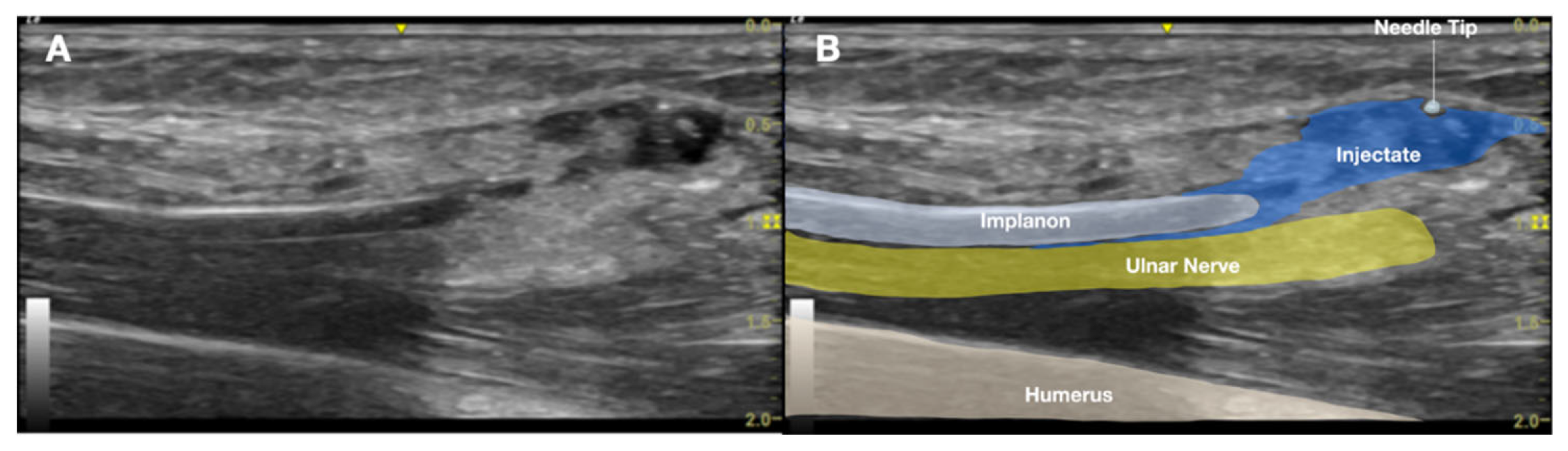 Preprints 171941 g006
