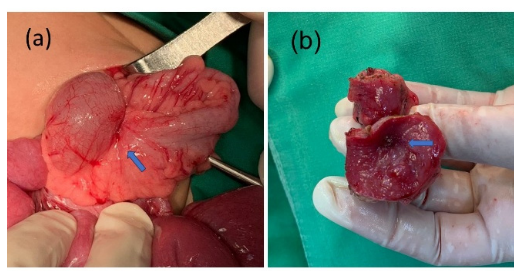 Preprints 224425 g004