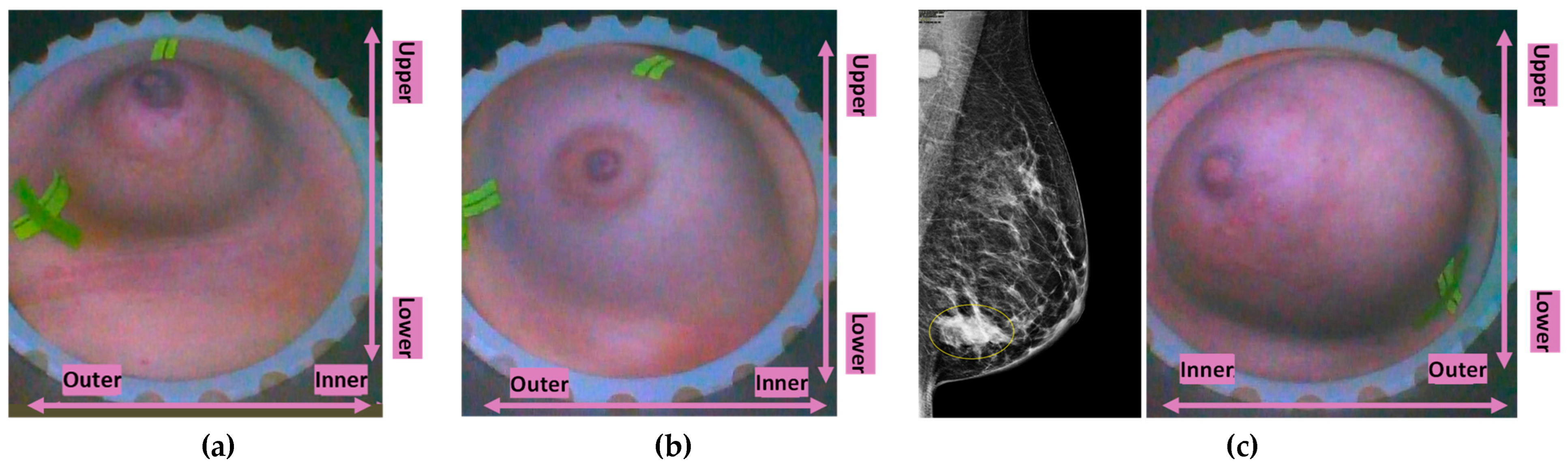 Preprints 171099 g004