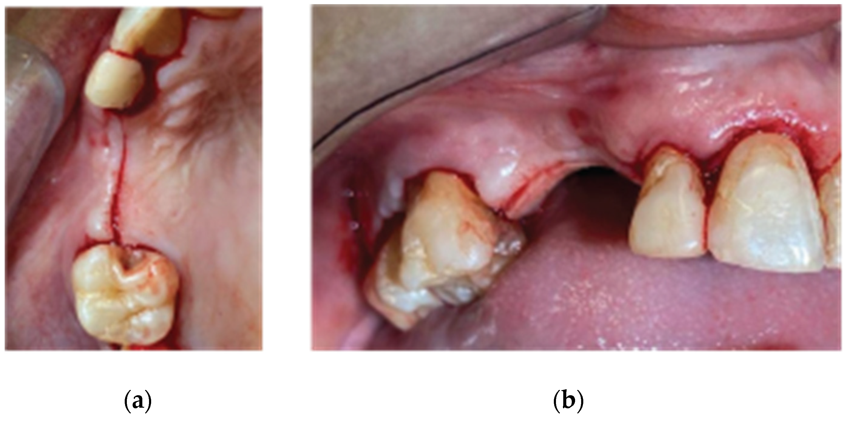 Preprints 87073 g003