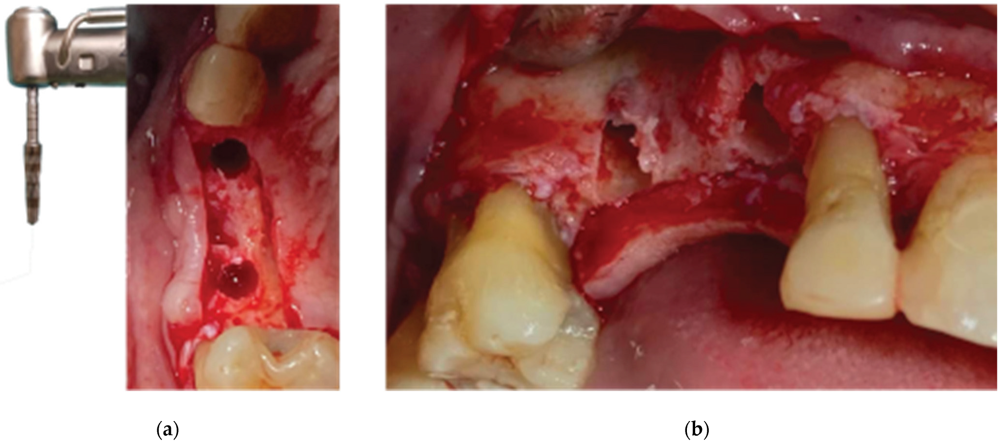 Preprints 87073 g005