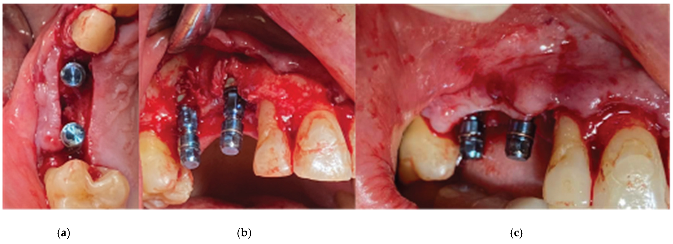 Preprints 87073 g006