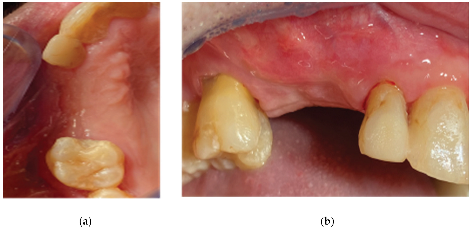 Preprints 87073 g011