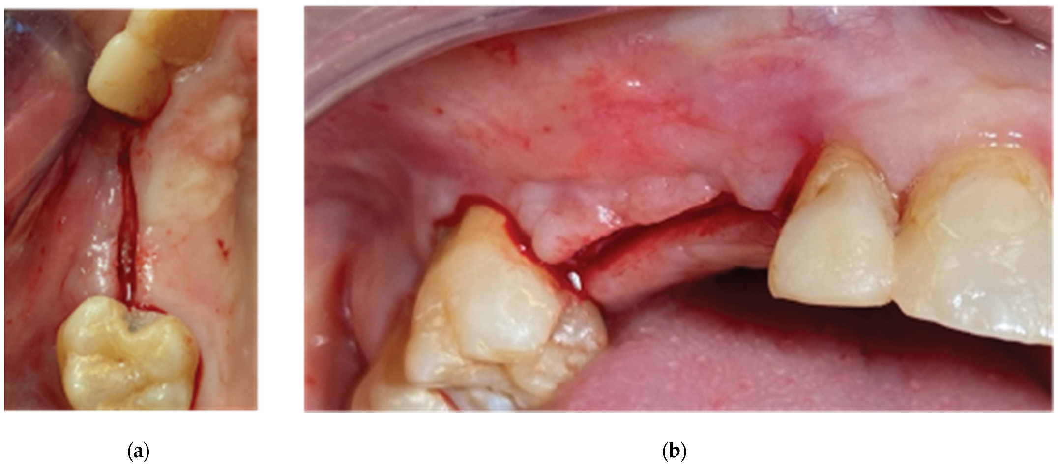 Preprints 87073 g013