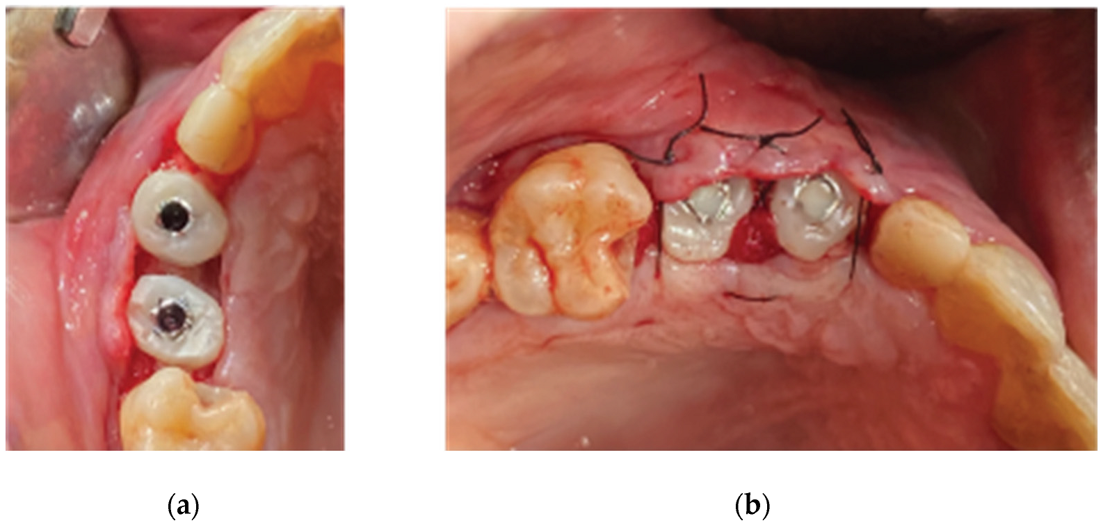 Preprints 87073 g015