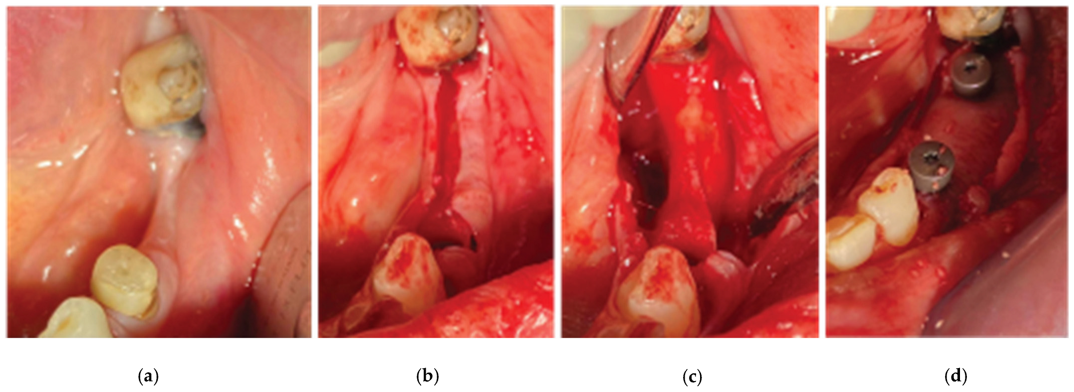 Preprints 87073 g017