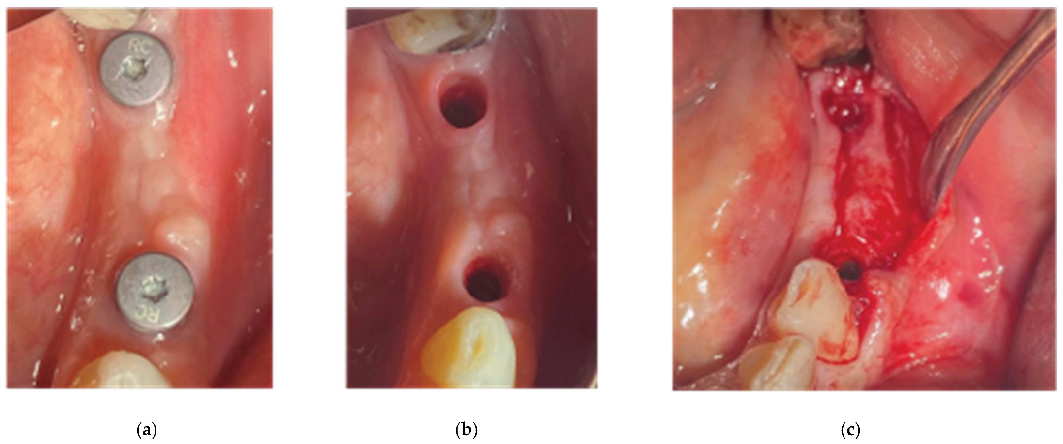 Preprints 87073 g018