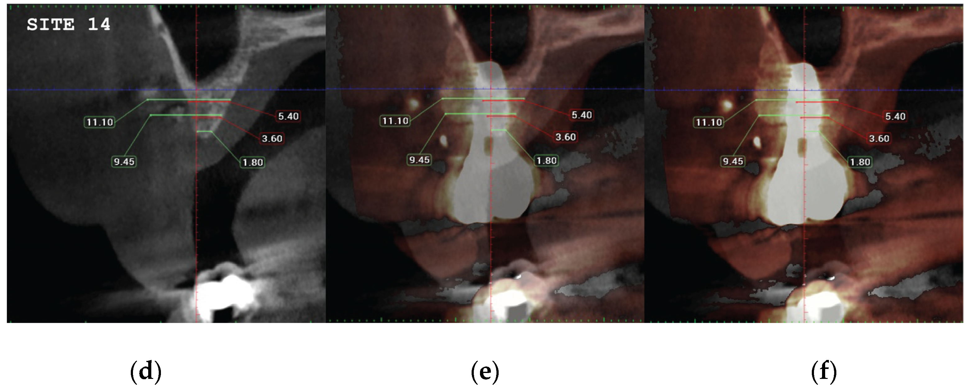 Preprints 87073 g021b