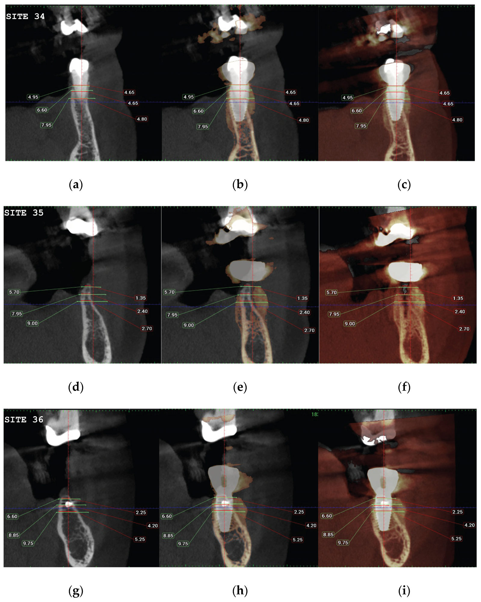 Preprints 87073 g022