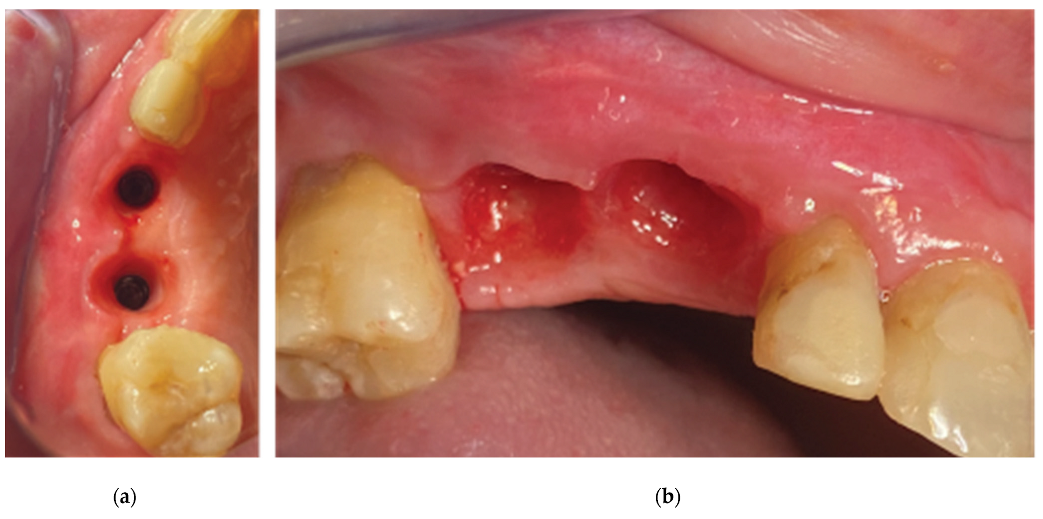 Preprints 87073 g024