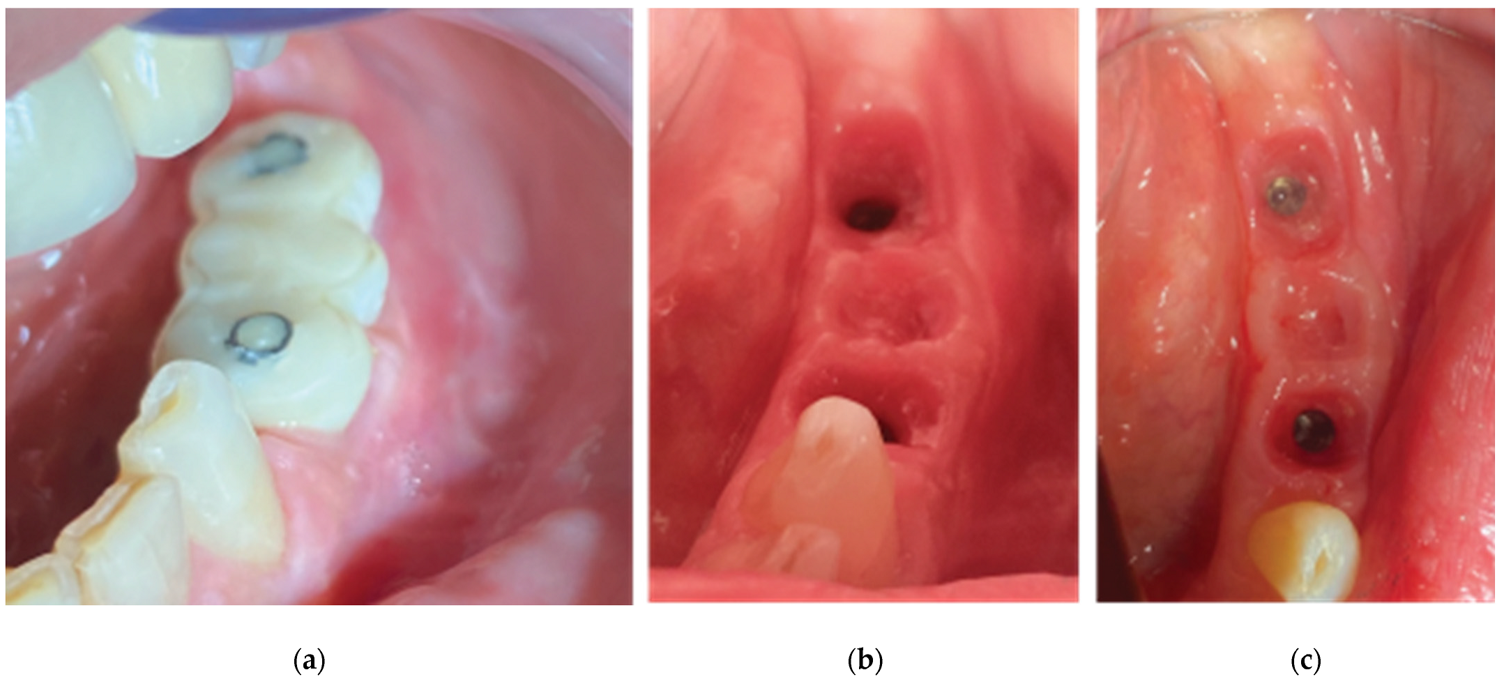 Preprints 87073 g025