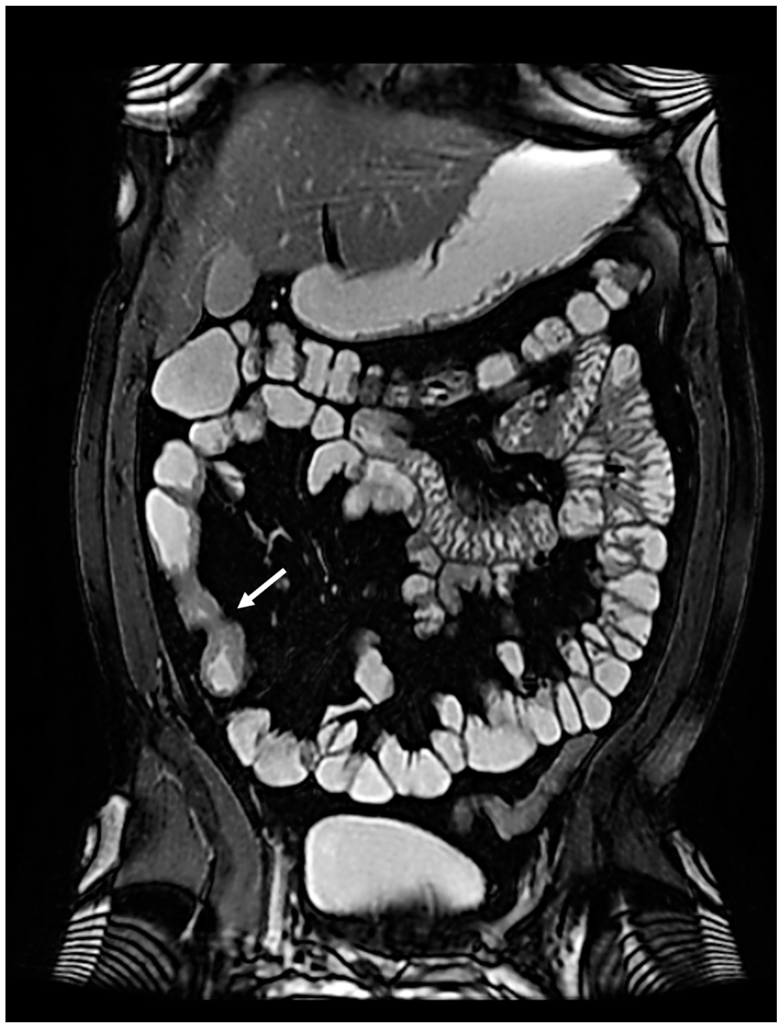 Preprints 82368 g002