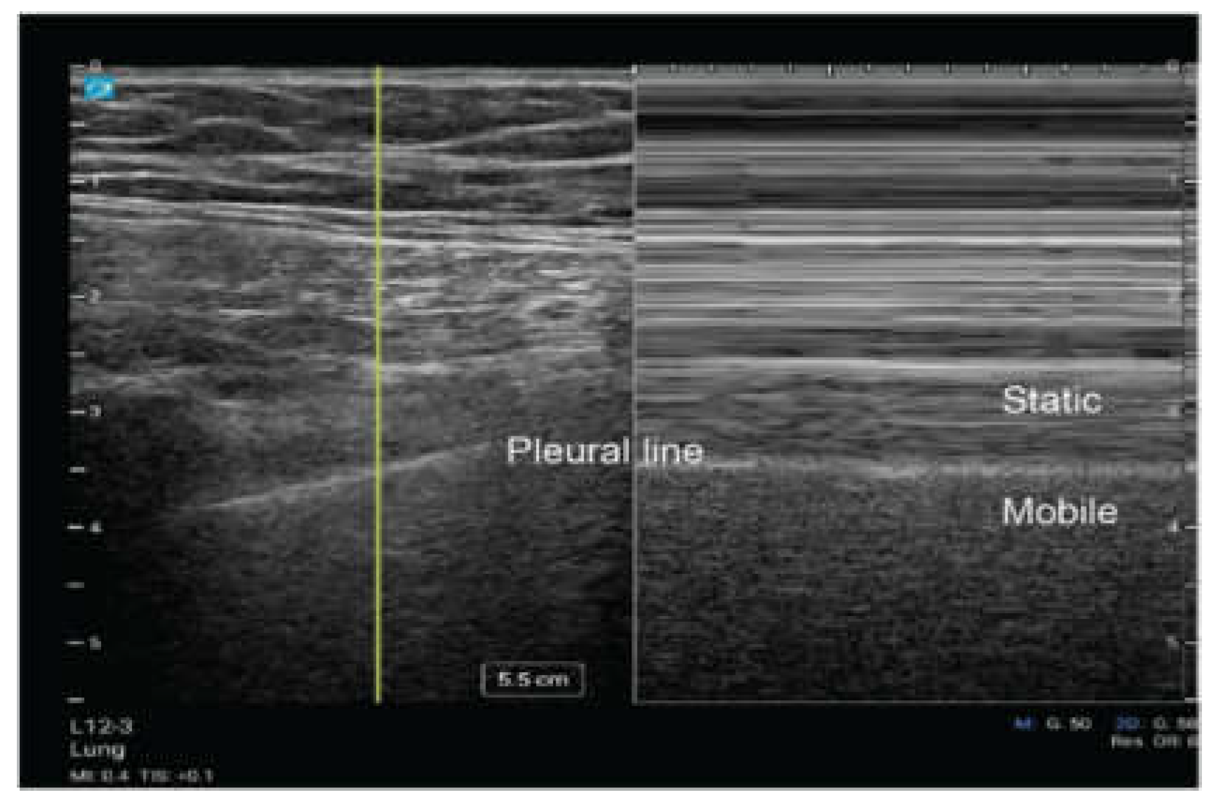 Preprints 155164 g004