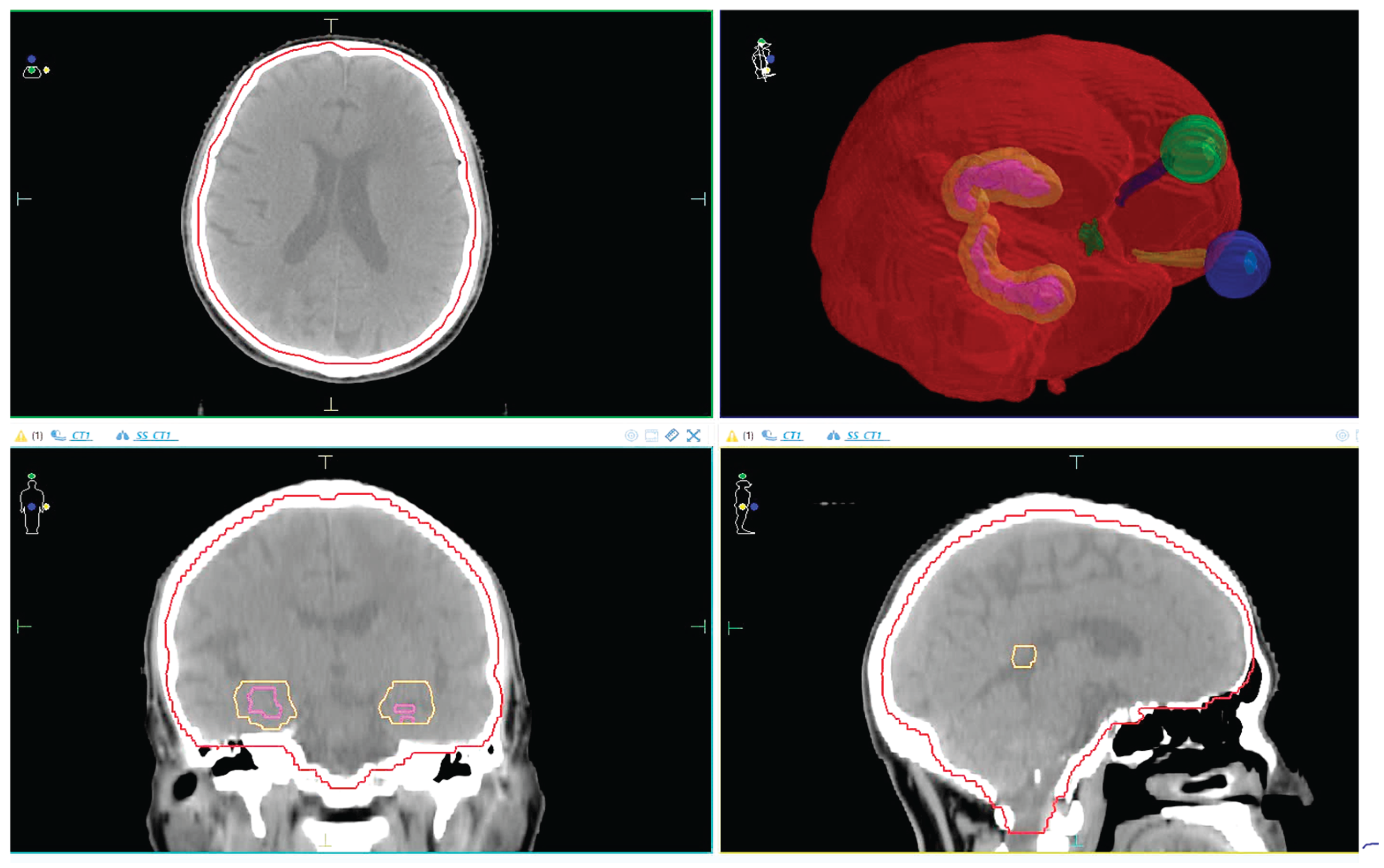 Preprints 181716 g001