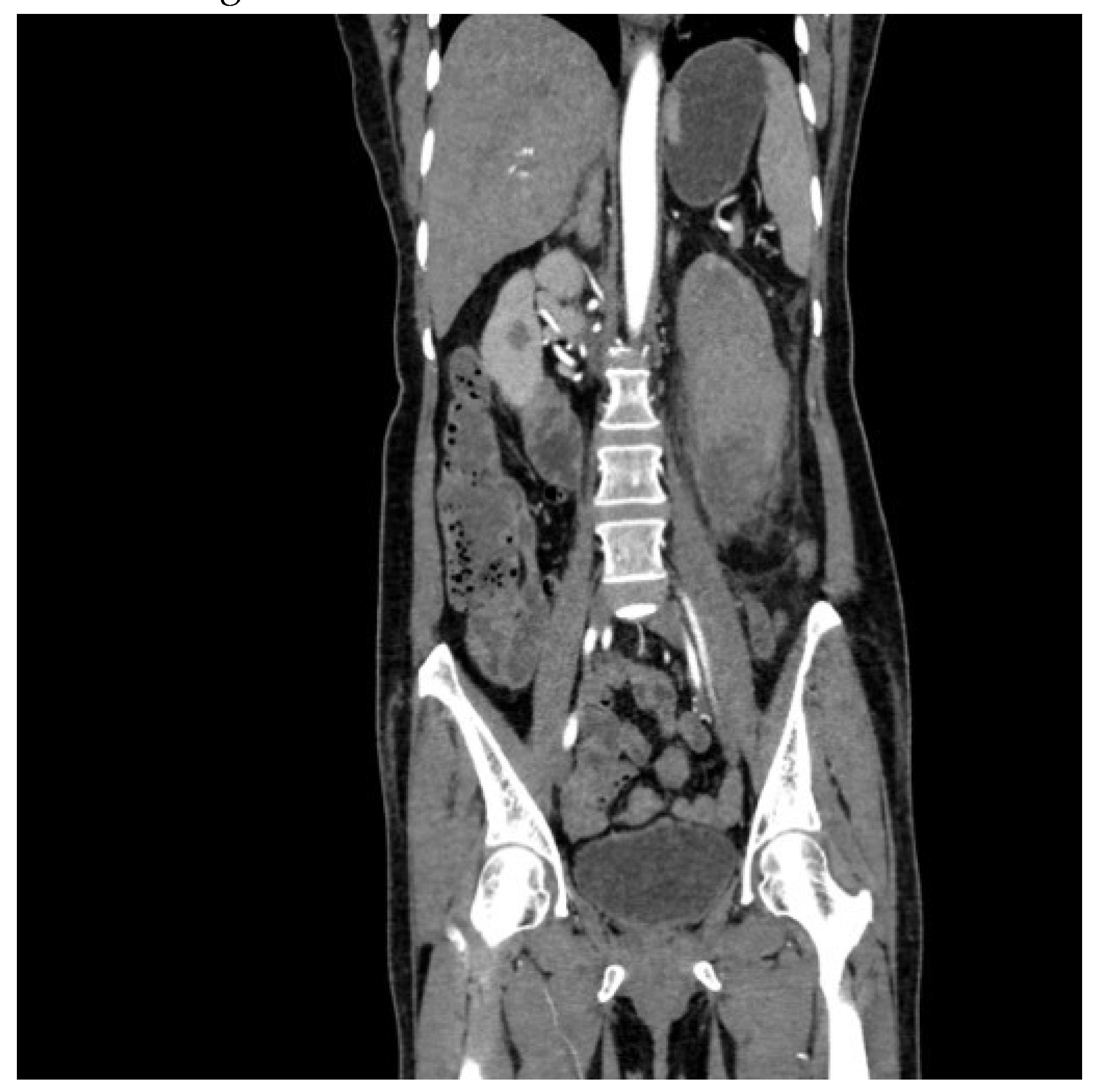 Preprints 139099 g001