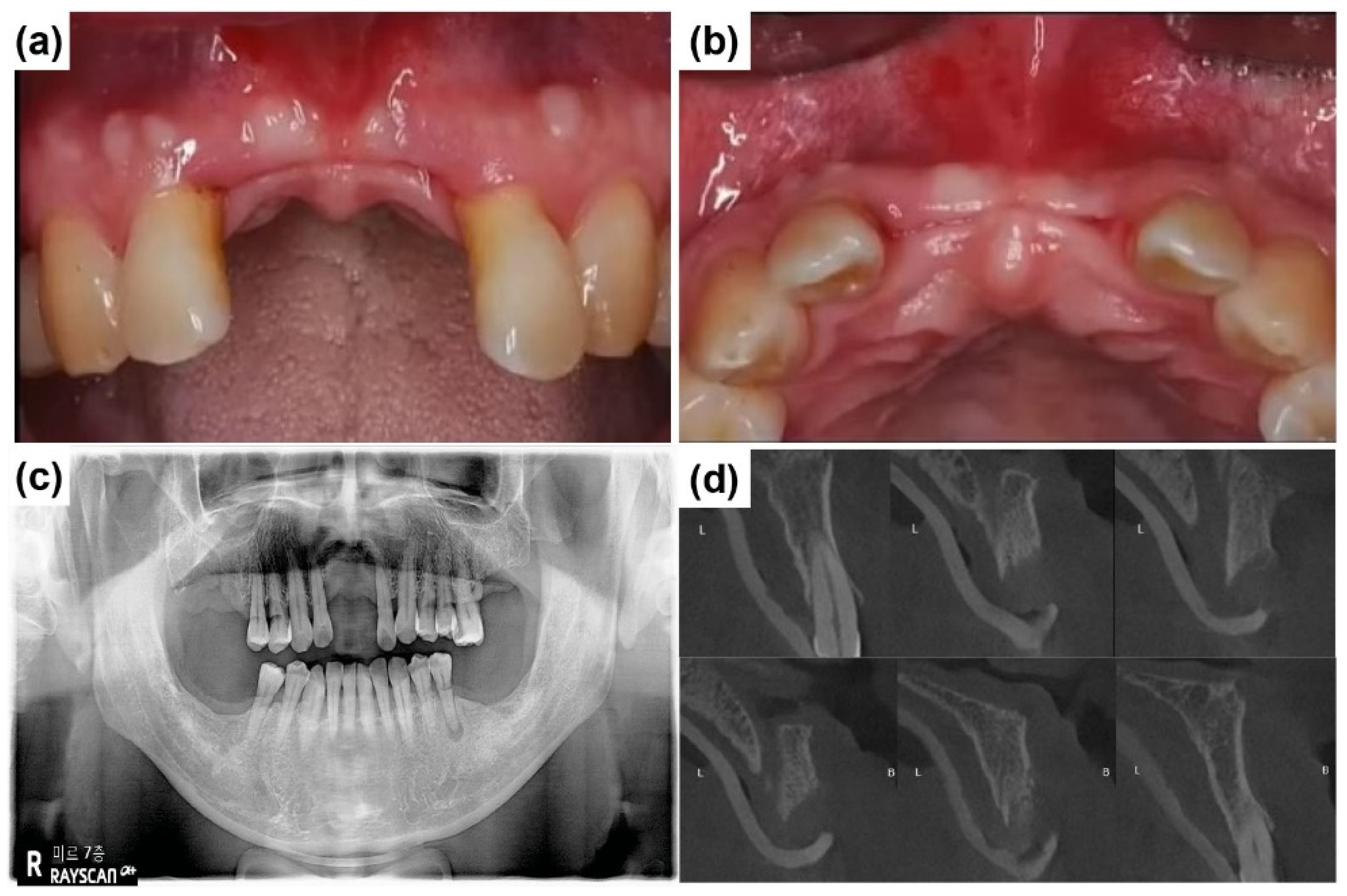 Preprints 155088 g003