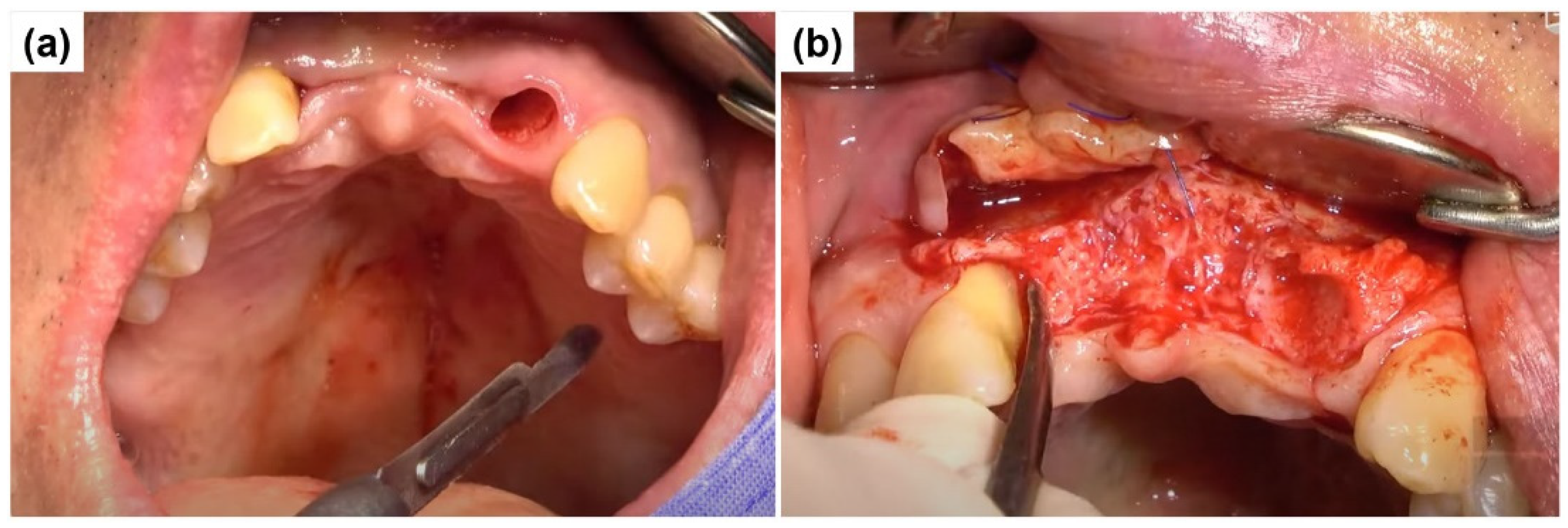 Preprints 155088 g004