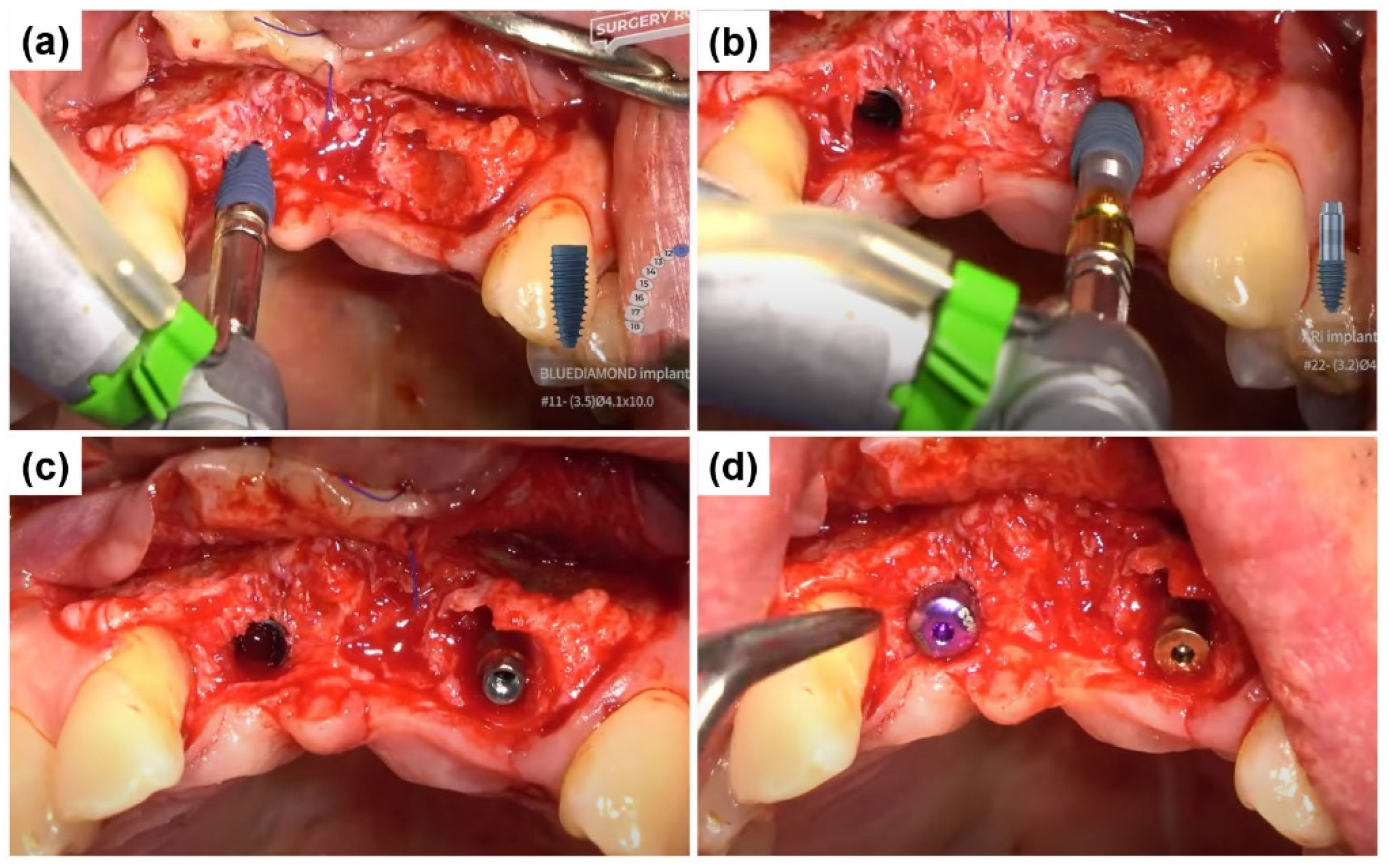 Preprints 155088 g005