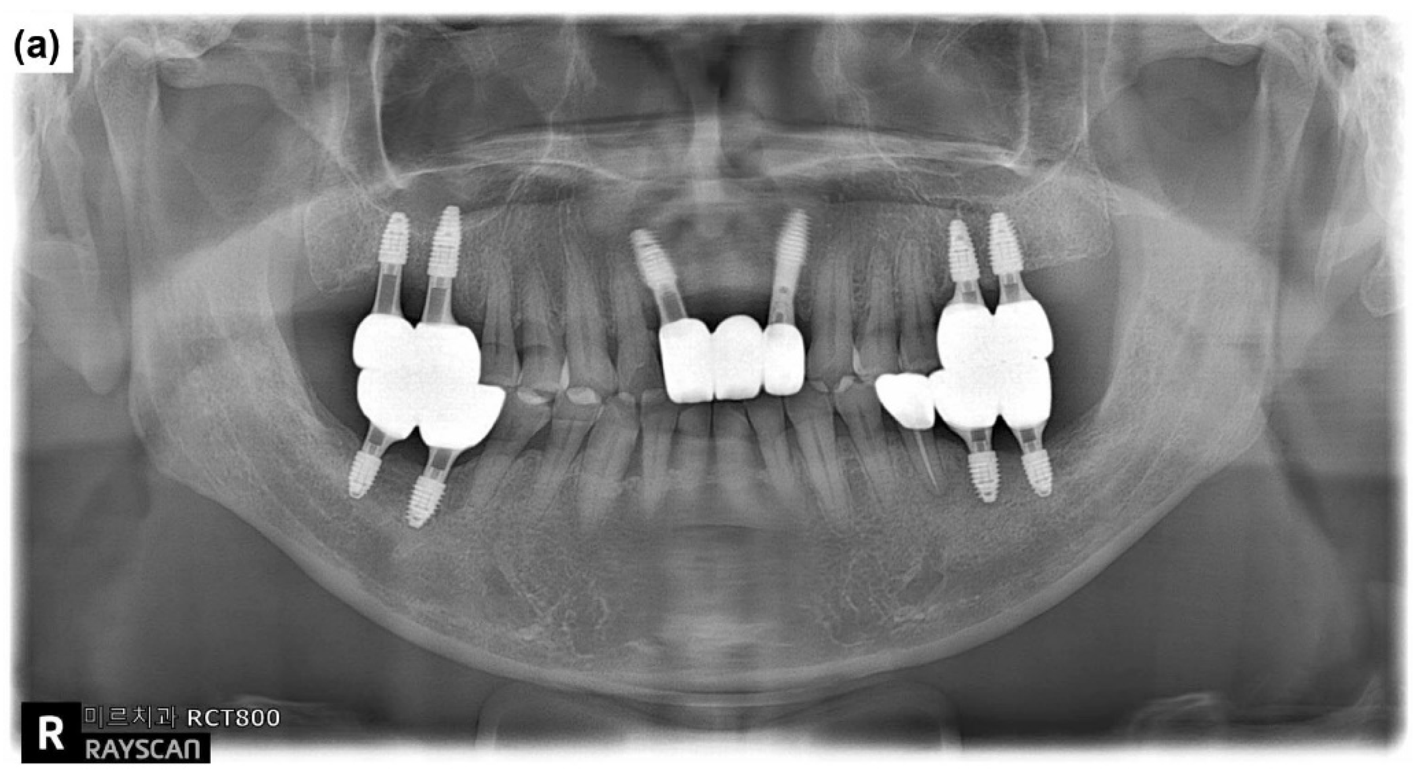 Preprints 155088 g011