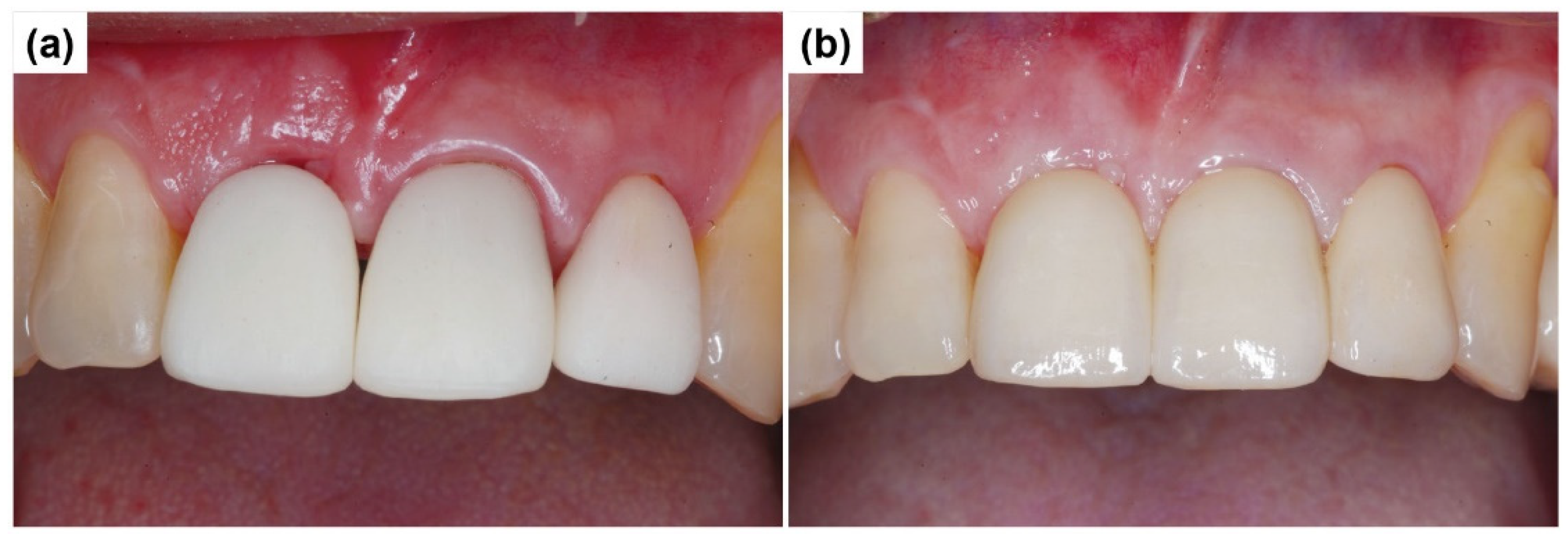 Preprints 155088 g014