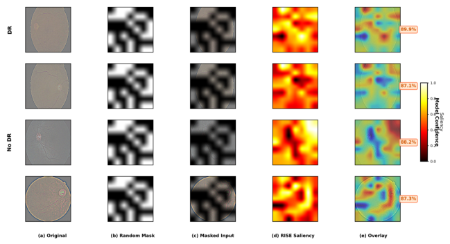 A Clinically-Aligned Multi-Family Explainable AI Framework for Diabetic ...