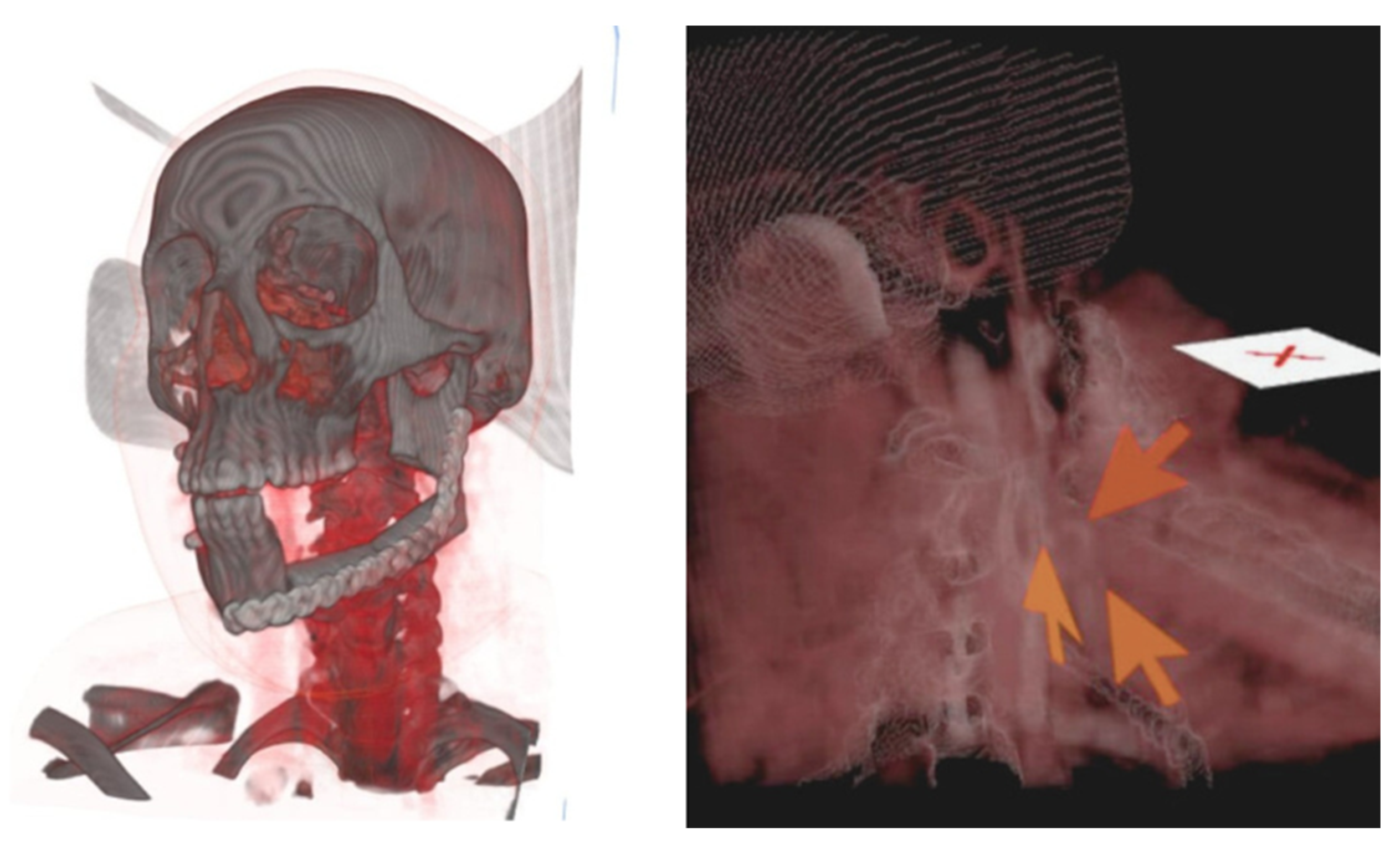 Preprints 170824 g003