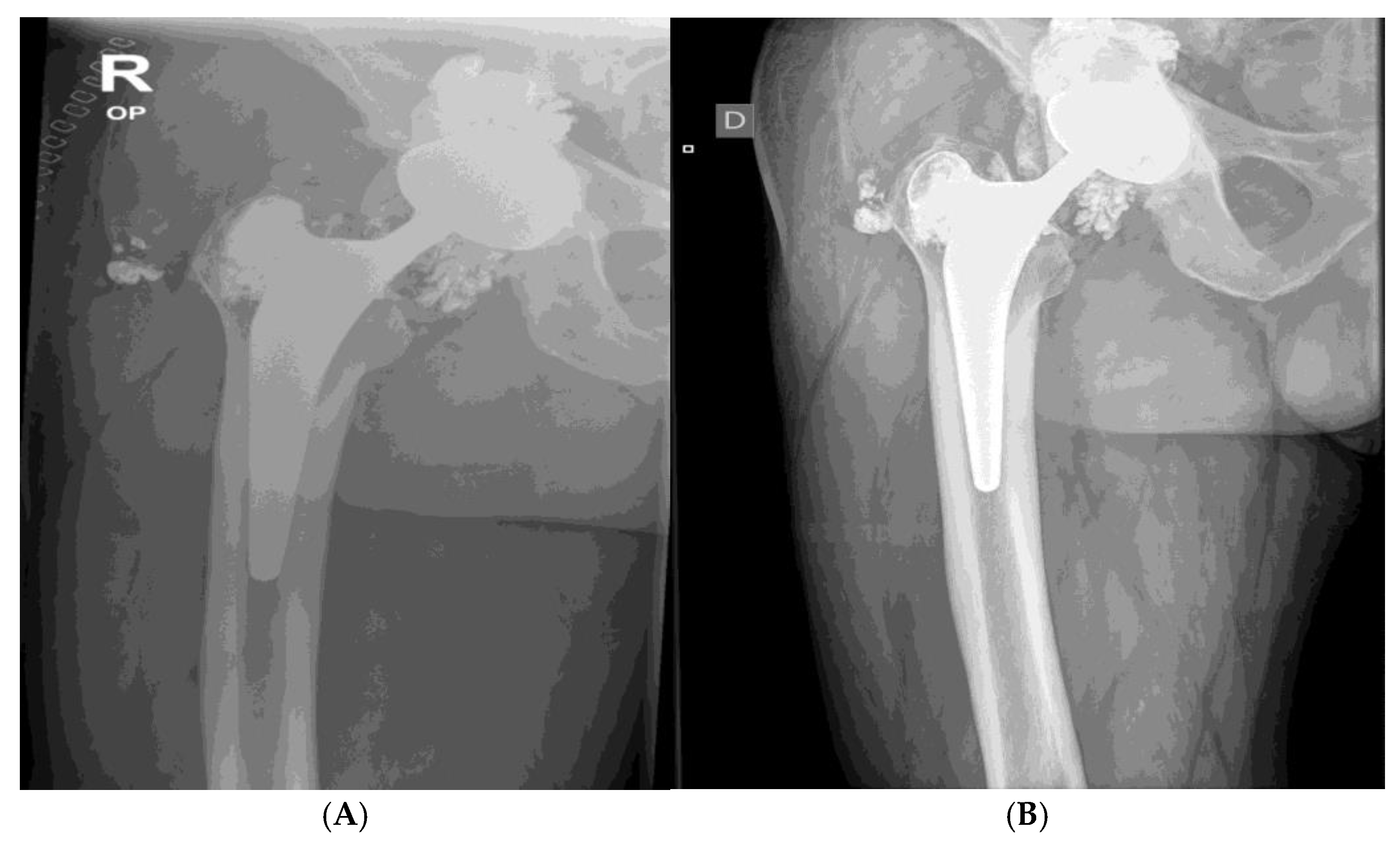 Preprints 171222 g005