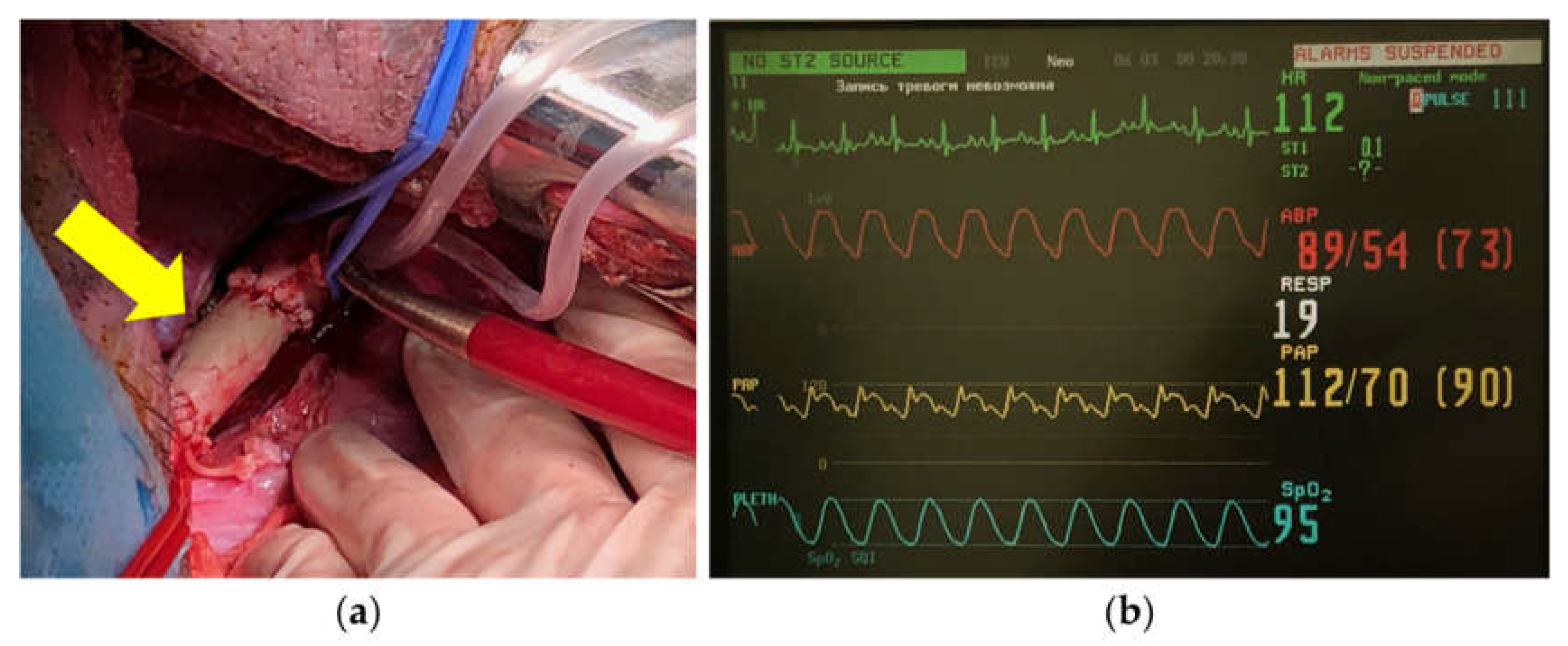 Preprints 141930 g010