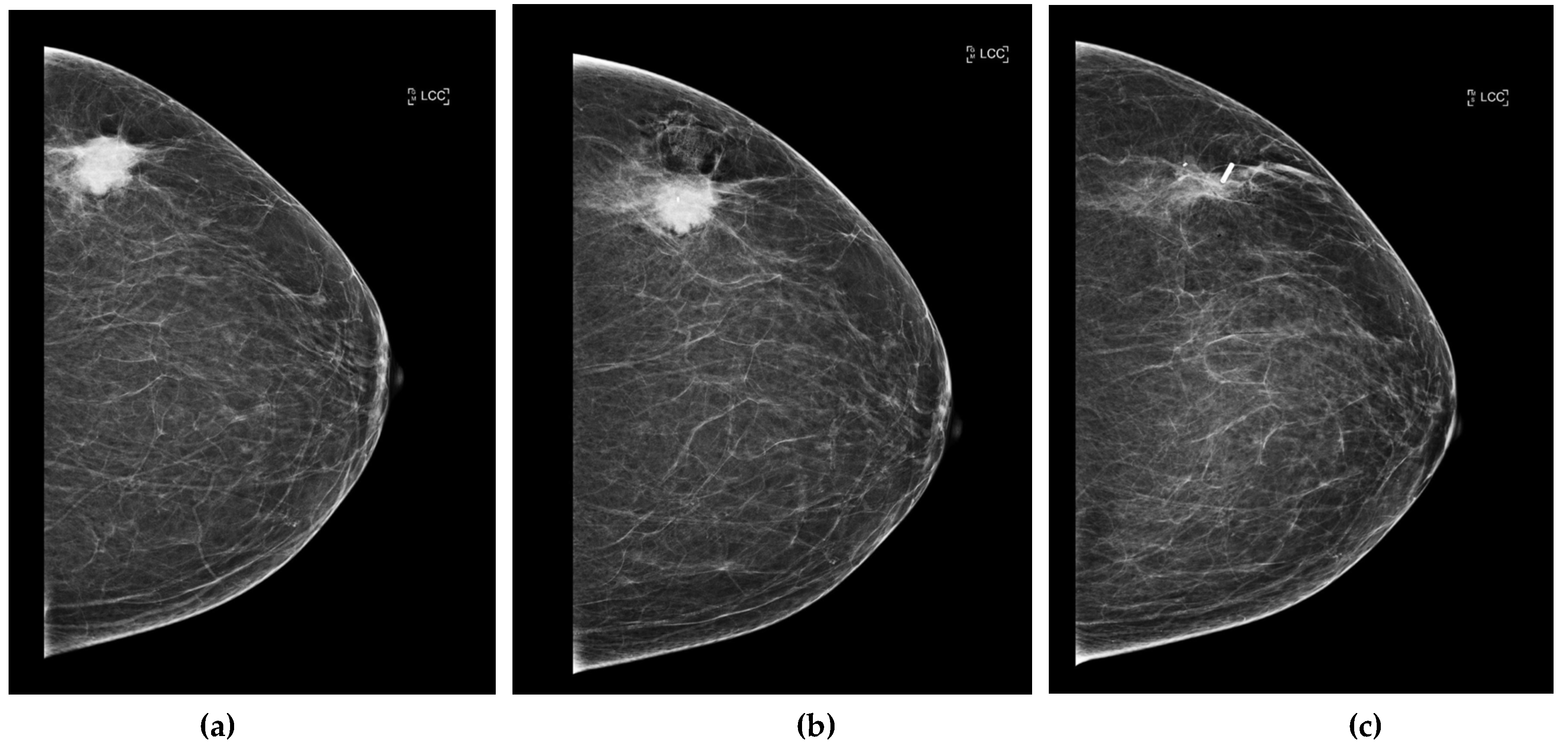 Preprints 148469 g003