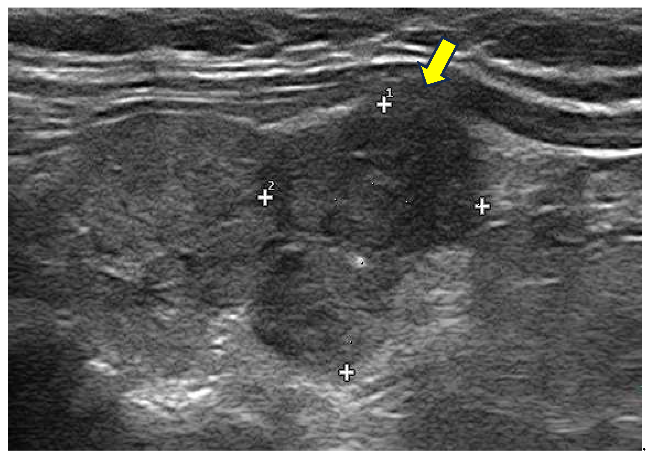 Preprints 156102 g005