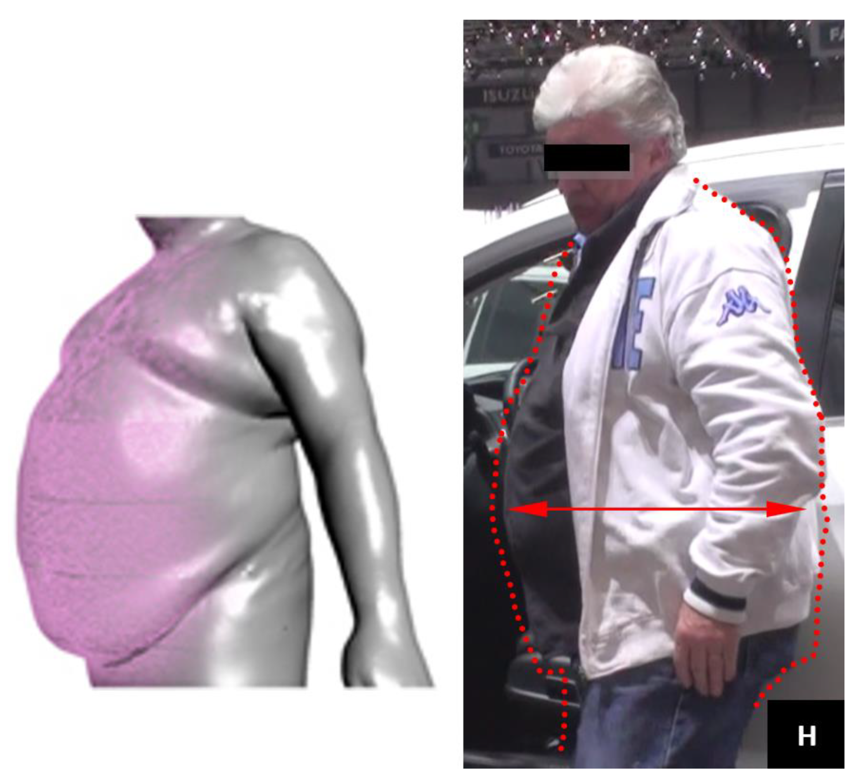 Preprints 79848 g0a14