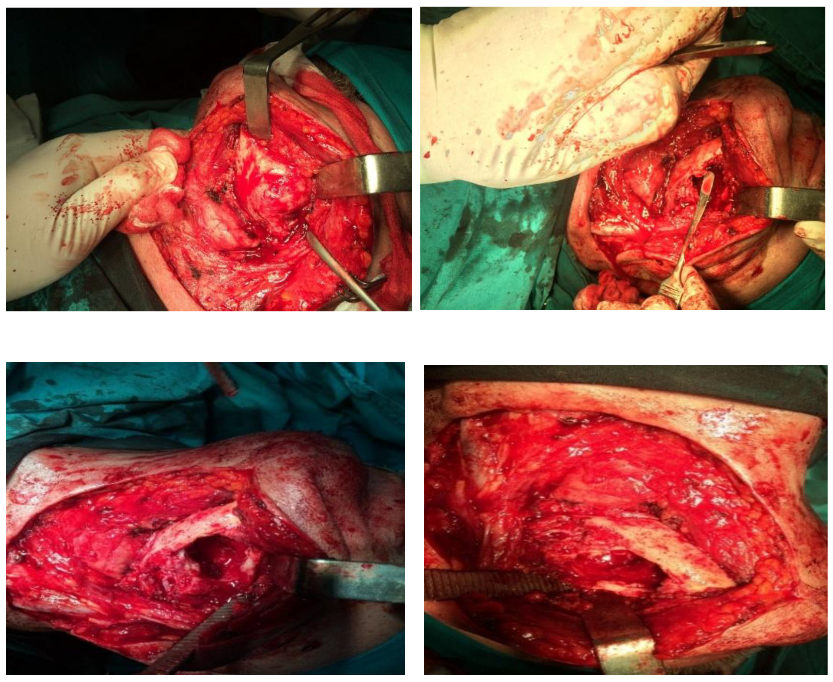 Preprints 160545 g004