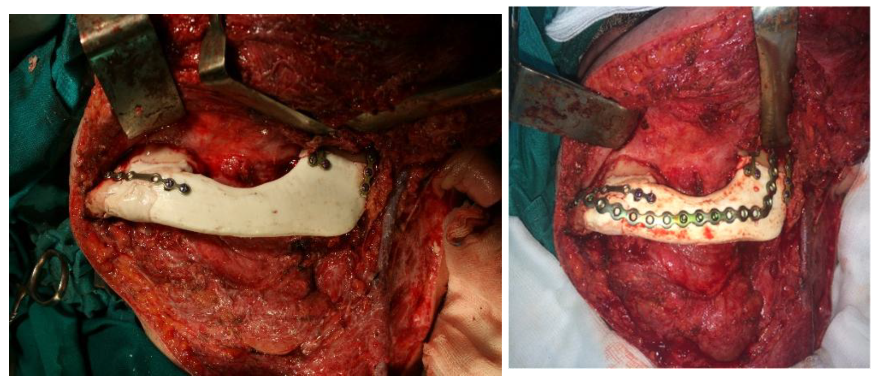 Preprints 160545 g012