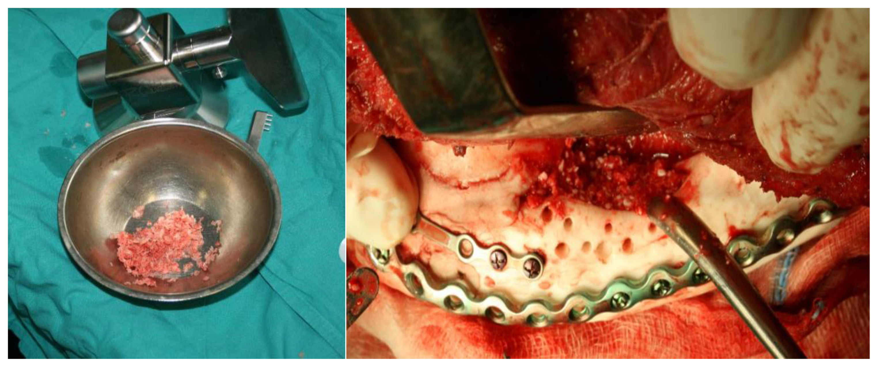 Preprints 160545 g014