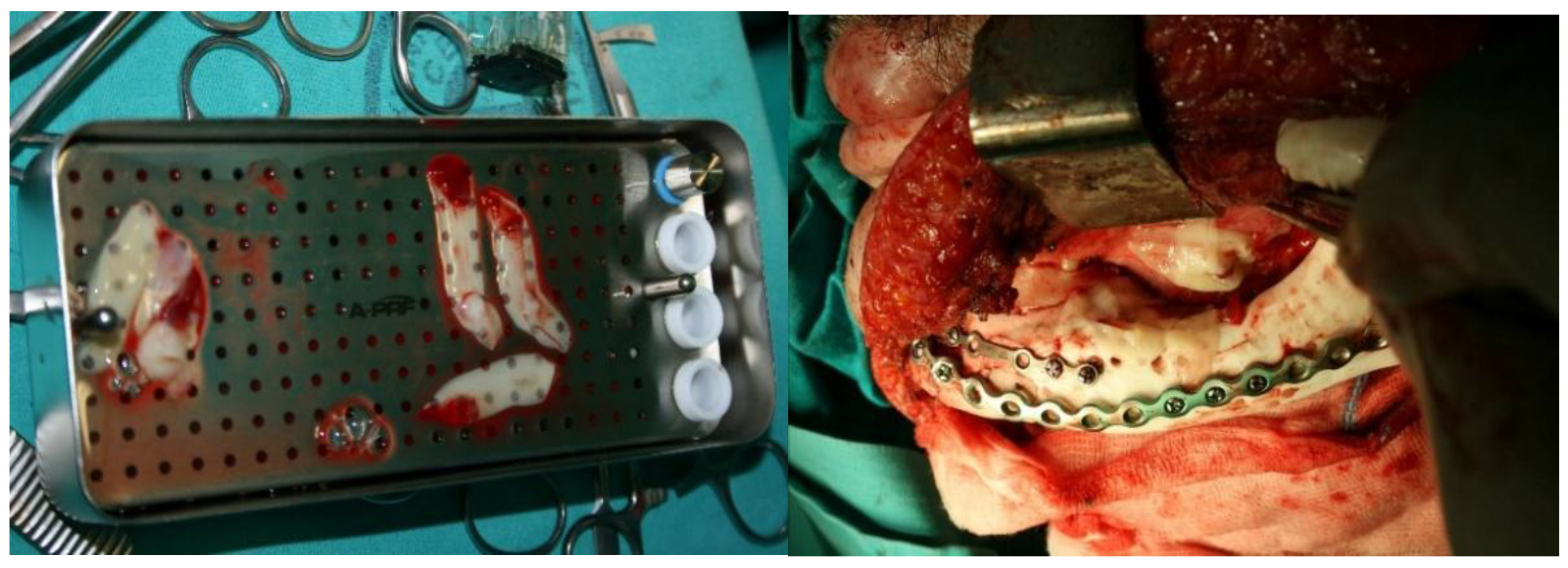 Preprints 160545 g015