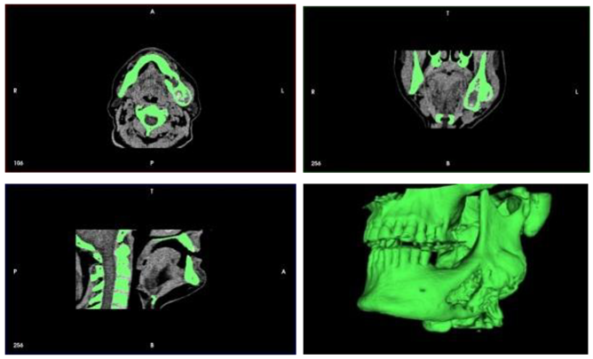 Preprints 160545 i001