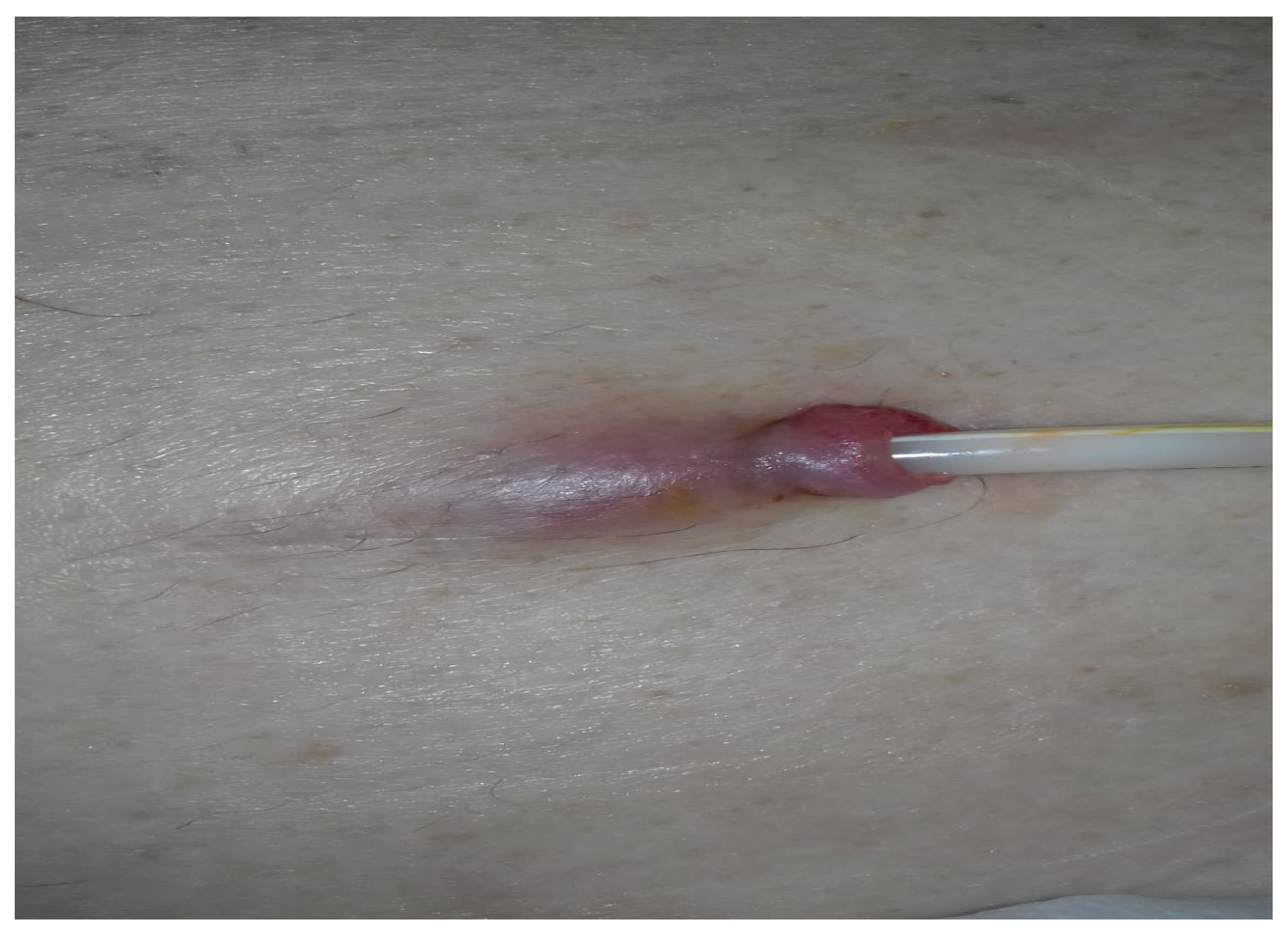 Preprints 108845 g001