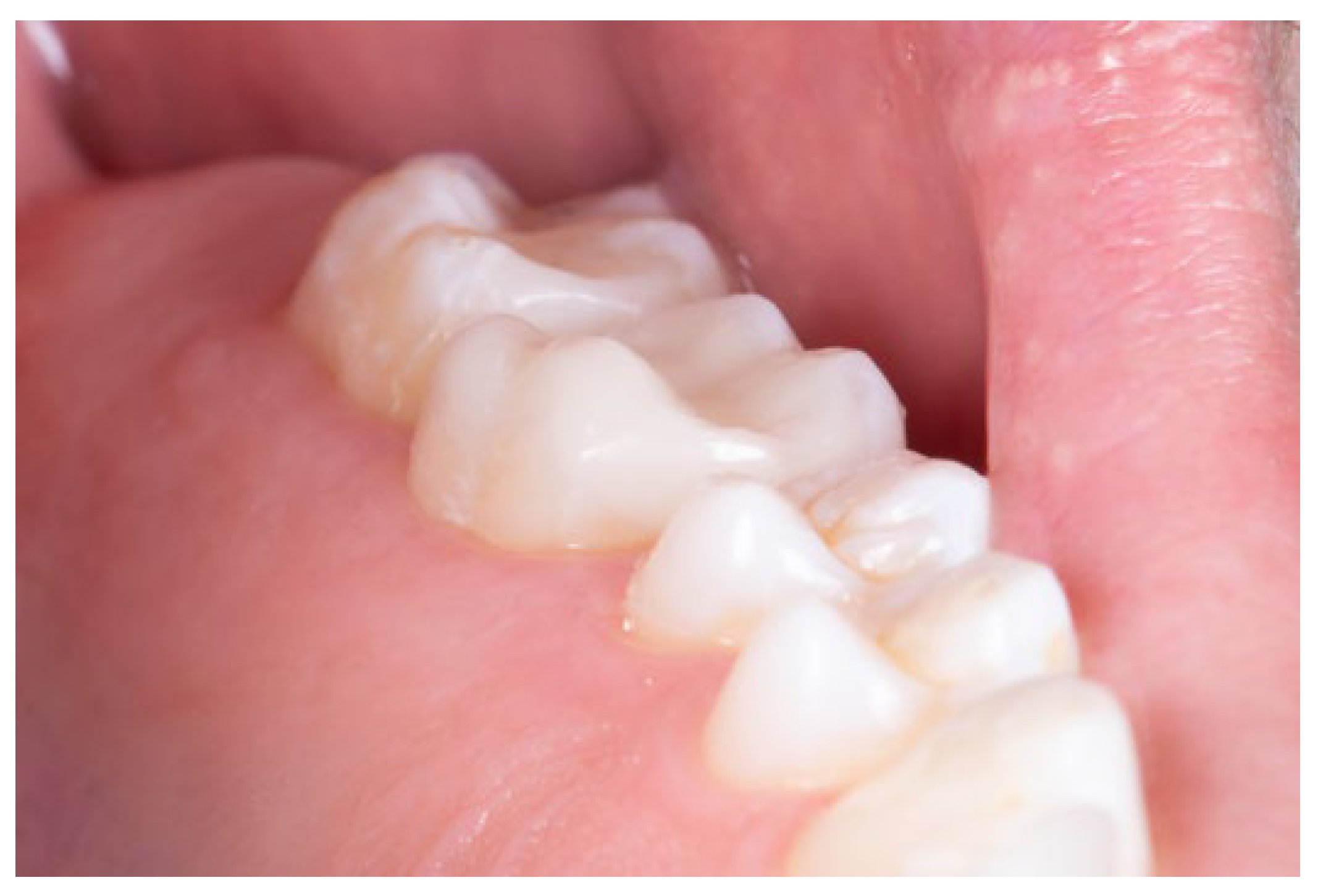 Preprints 195282 g013