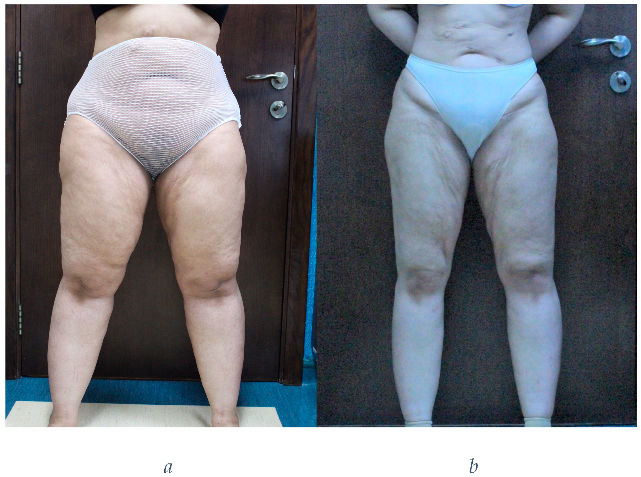 Preprints 151219 g002