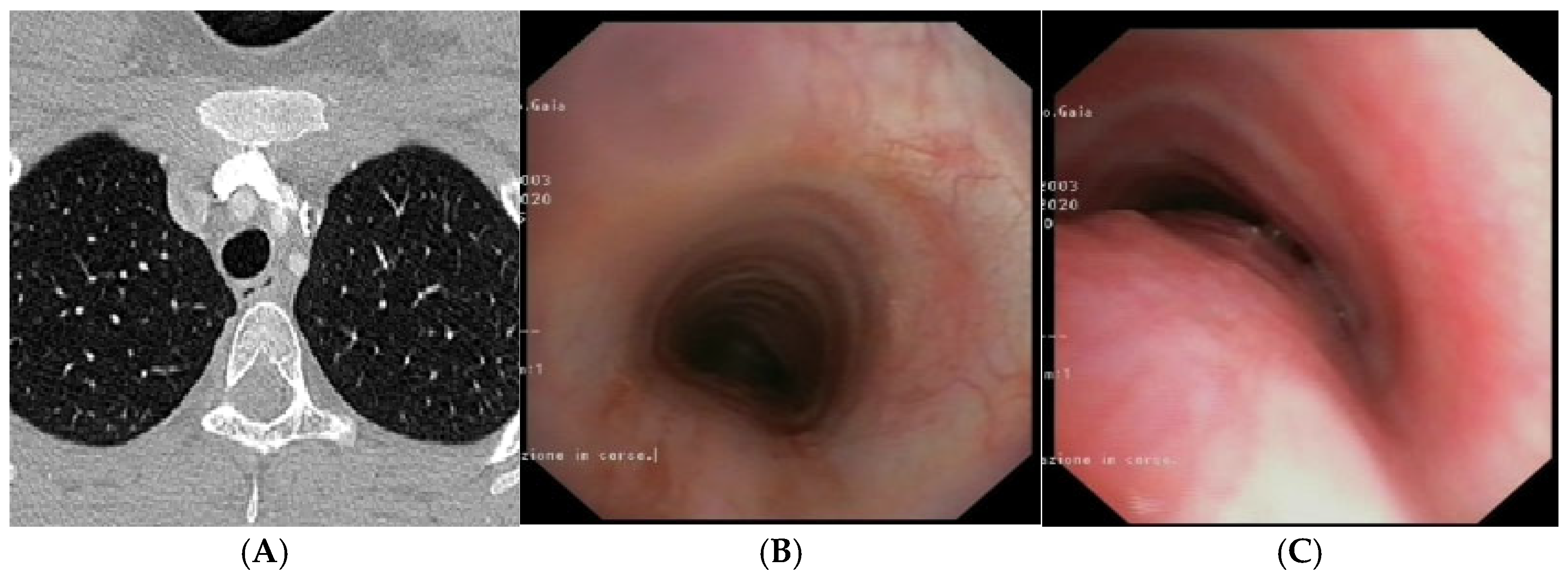 Preprints 172178 g006