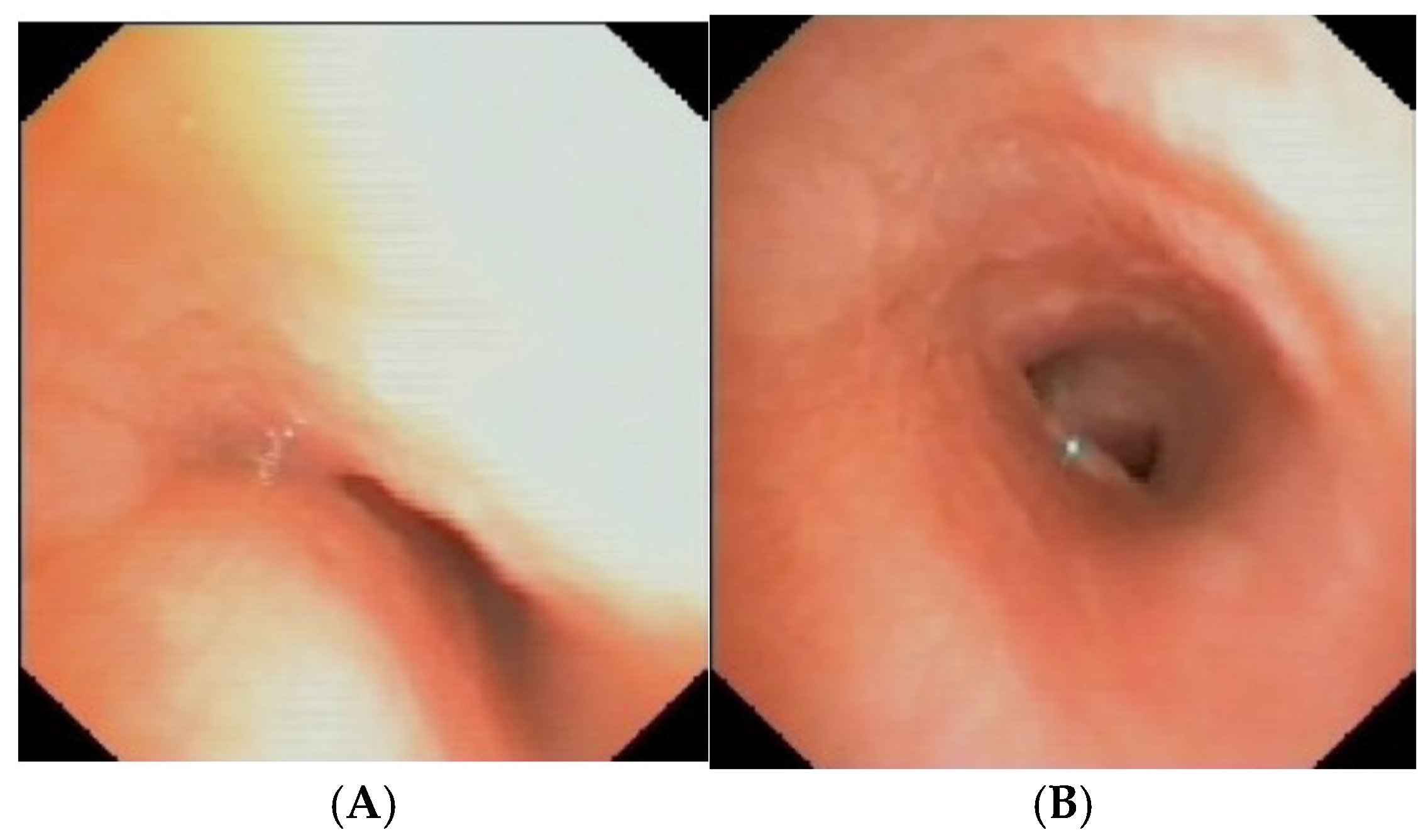 Preprints 172178 g011