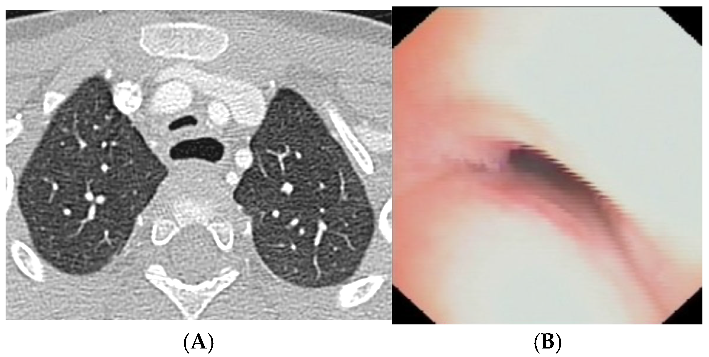 Preprints 172178 g012