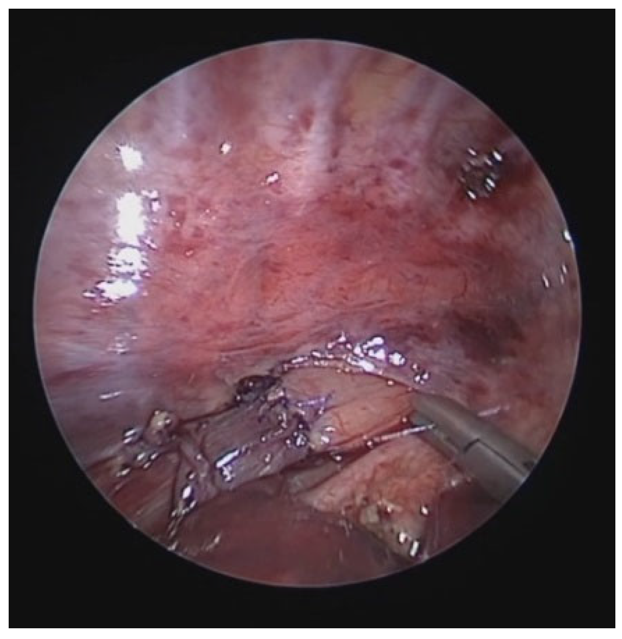 Preprints 172178 g014