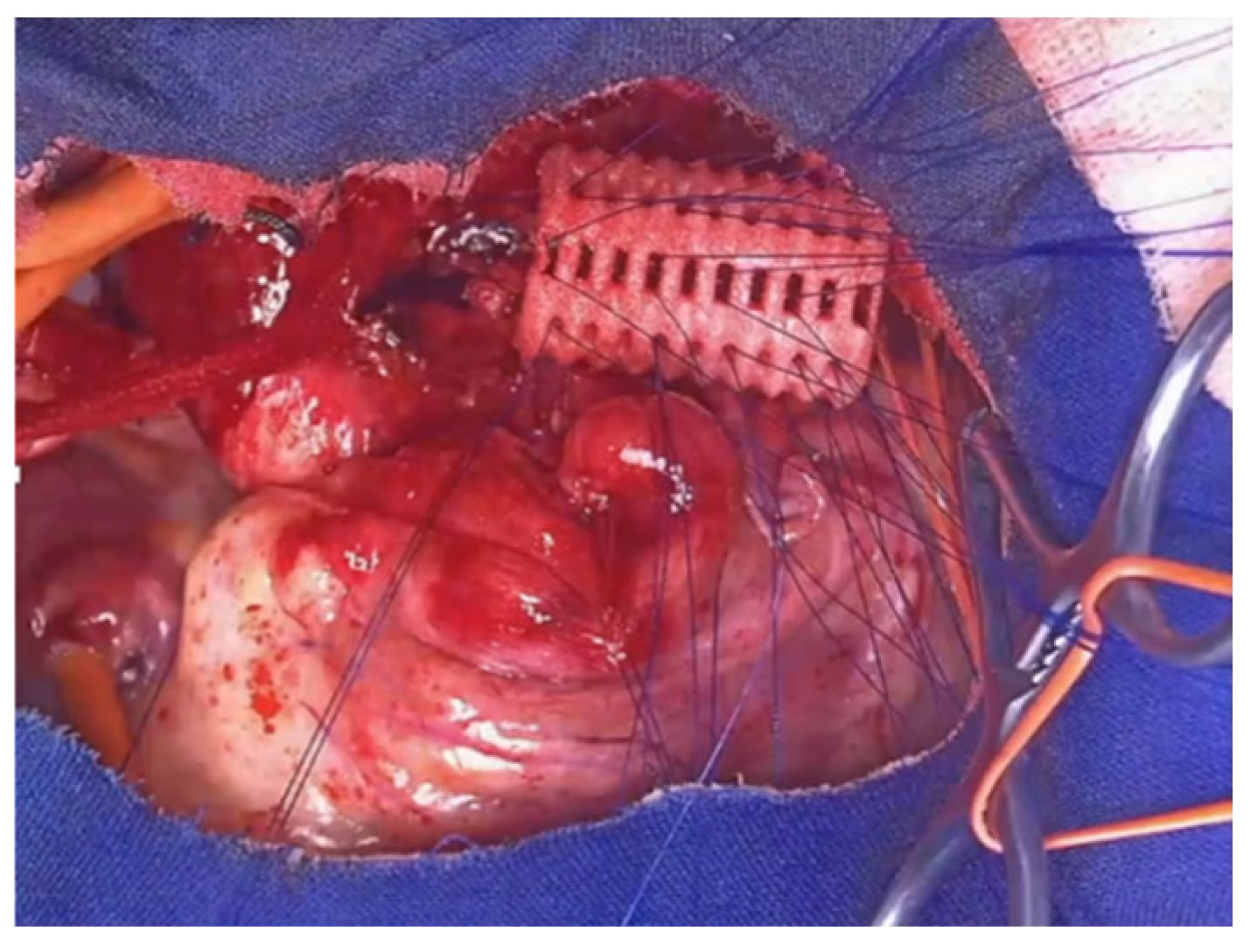 Preprints 172178 g018