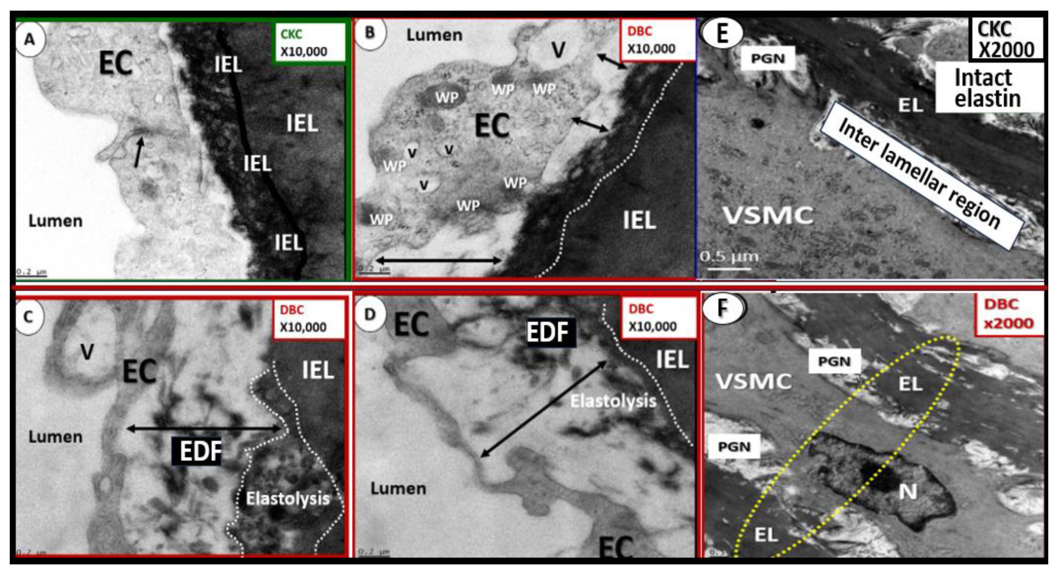 Preprints 145907 g014
