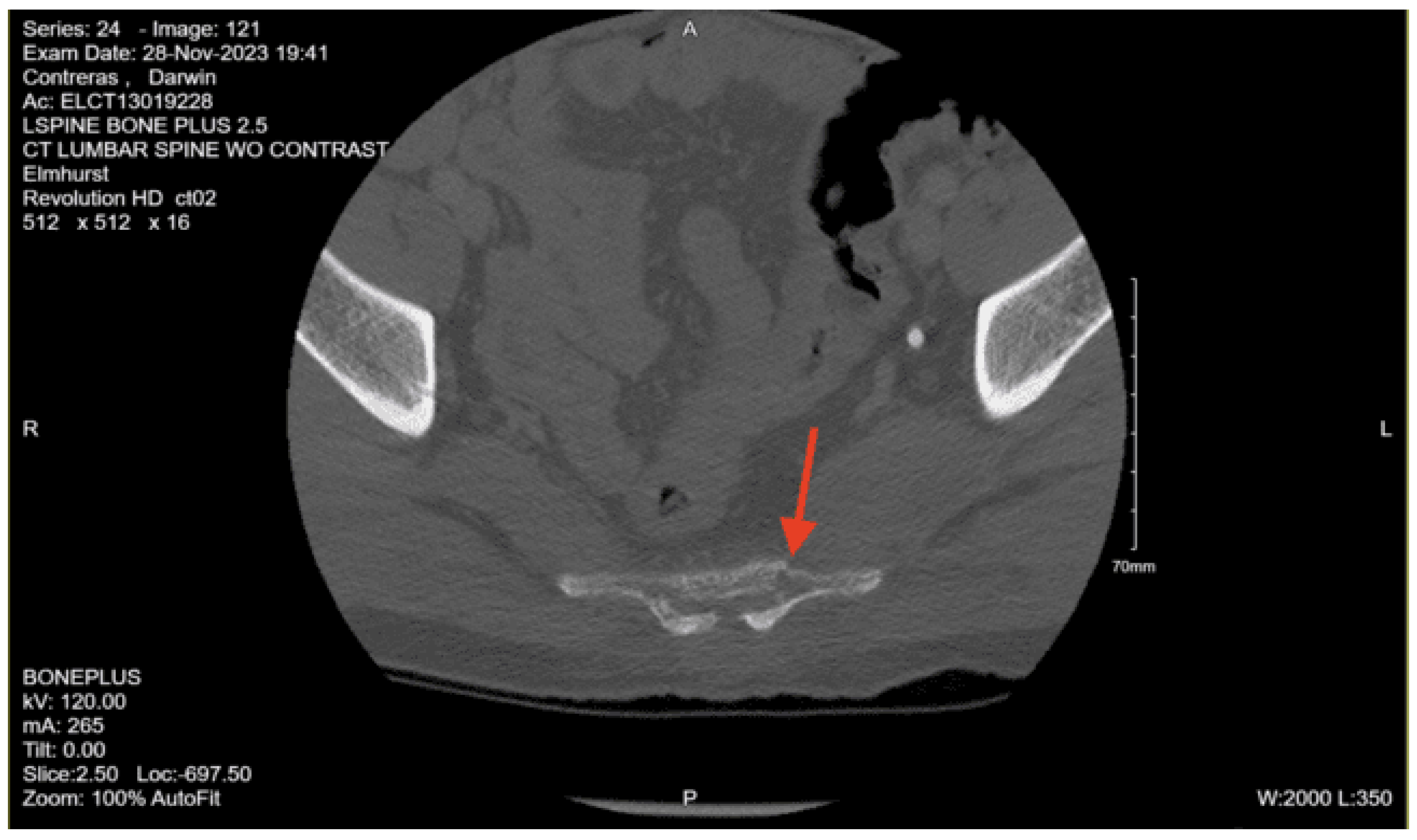 Preprints 157740 g014