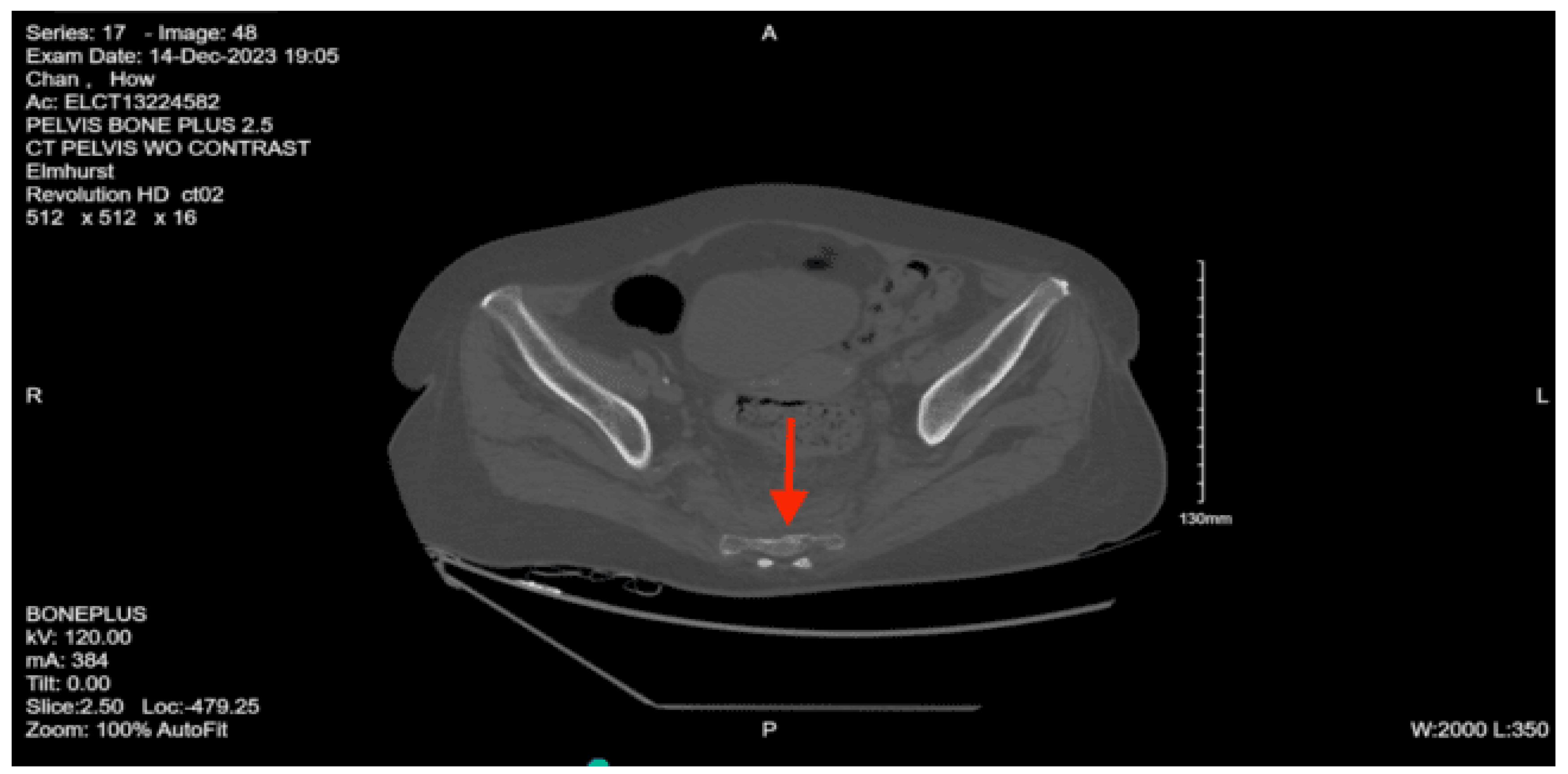 Preprints 157740 g015